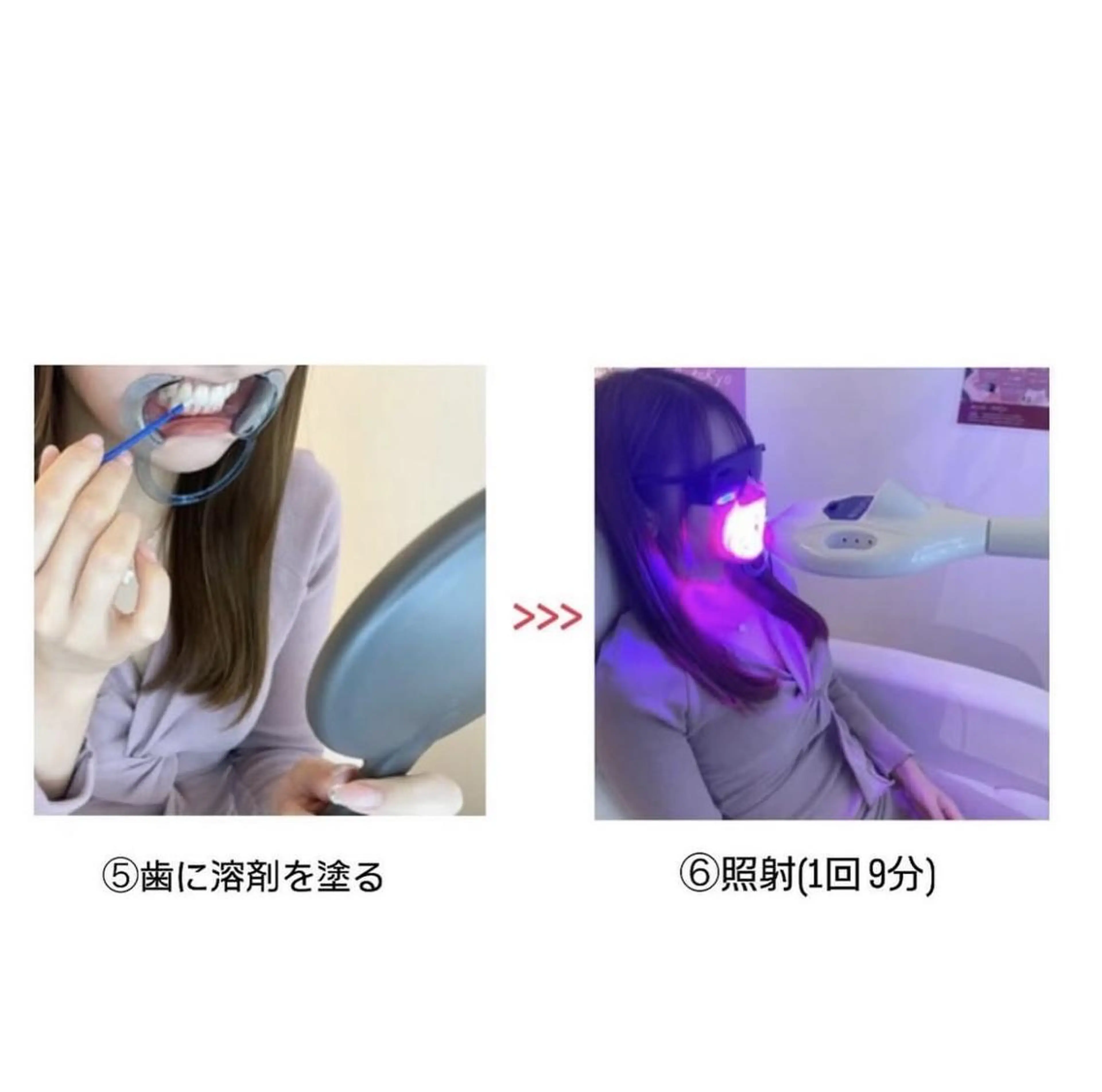 セルフホワイトニング エクシア大阪梅田店のその他イメージ