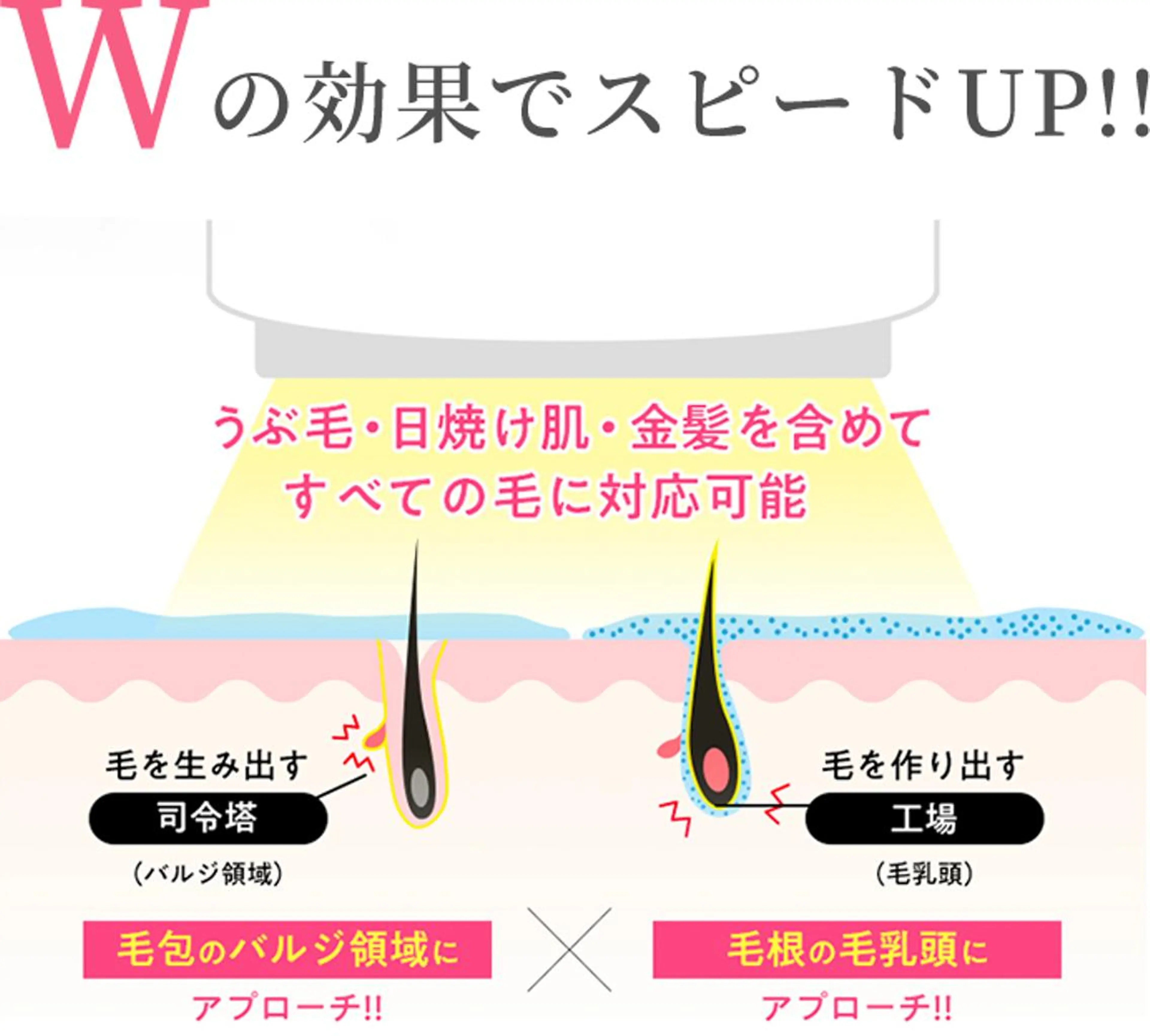 ミニモ限定❤︎全身脱毛1回の写真