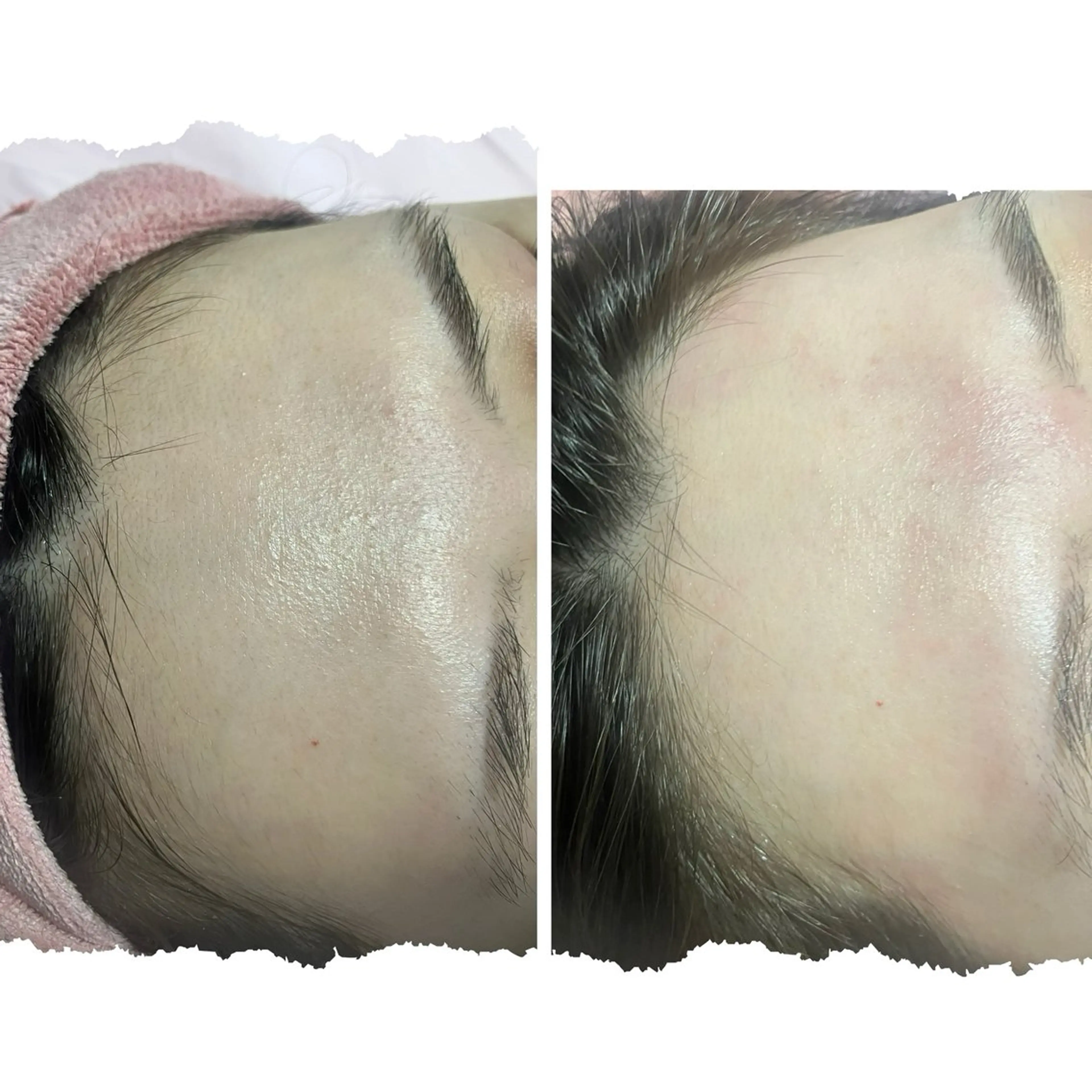 ウルツヤ肌に✨フェイシャルWax ￥6600 60分の写真