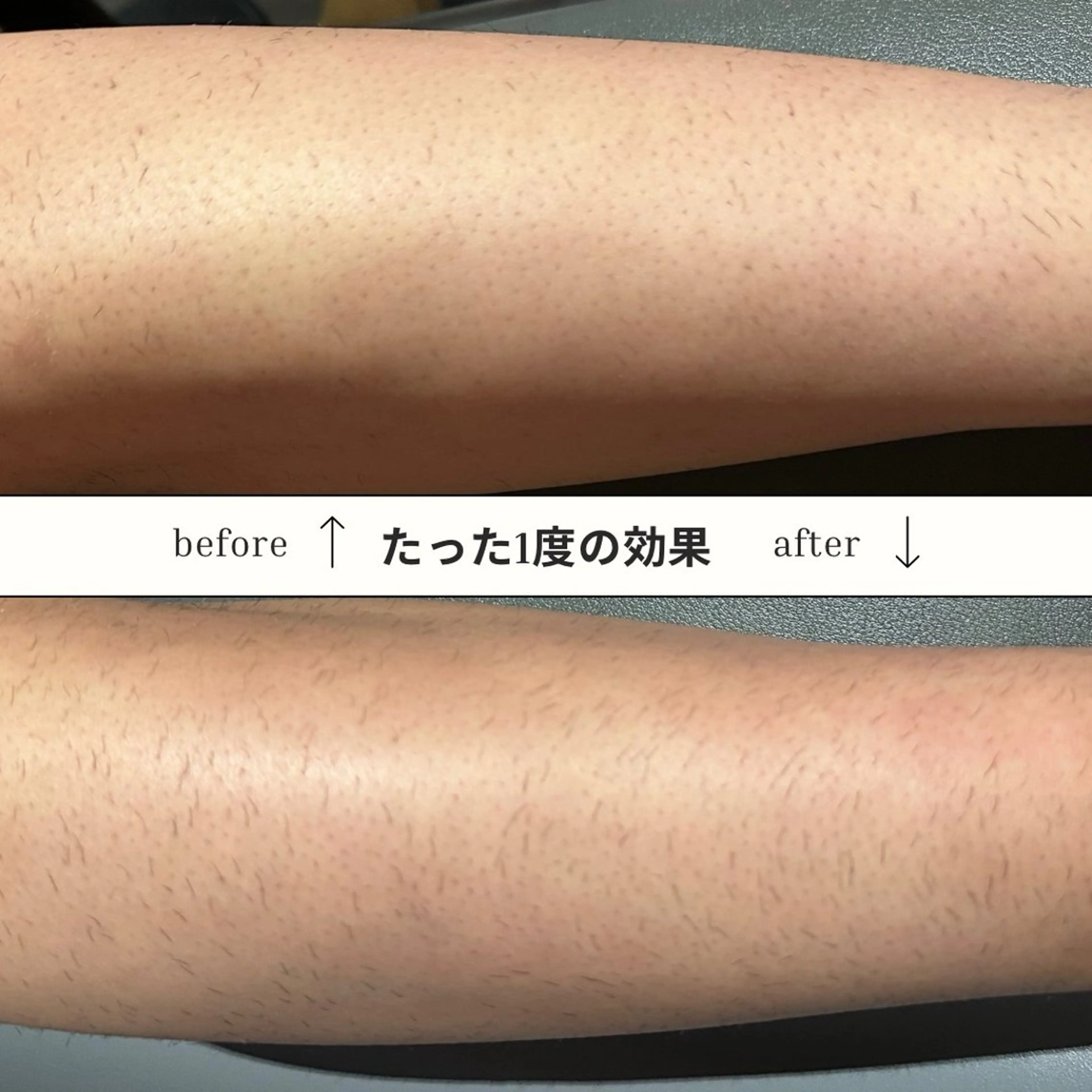 脱毛 平舘 友香のエステ・リラクイメージ