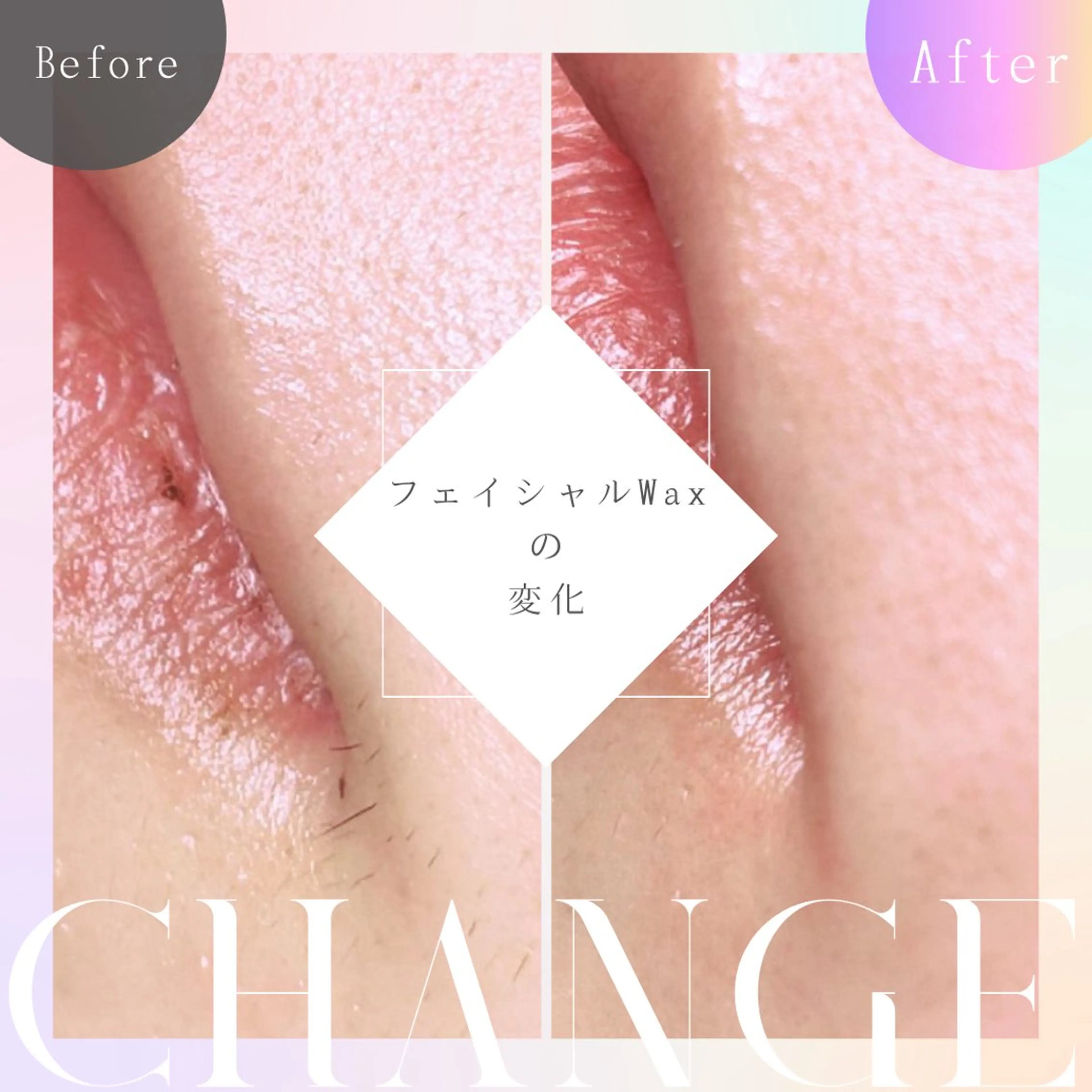 ワックス脱毛🌈 ESPOIRnocoのエステ・リラクイメージ