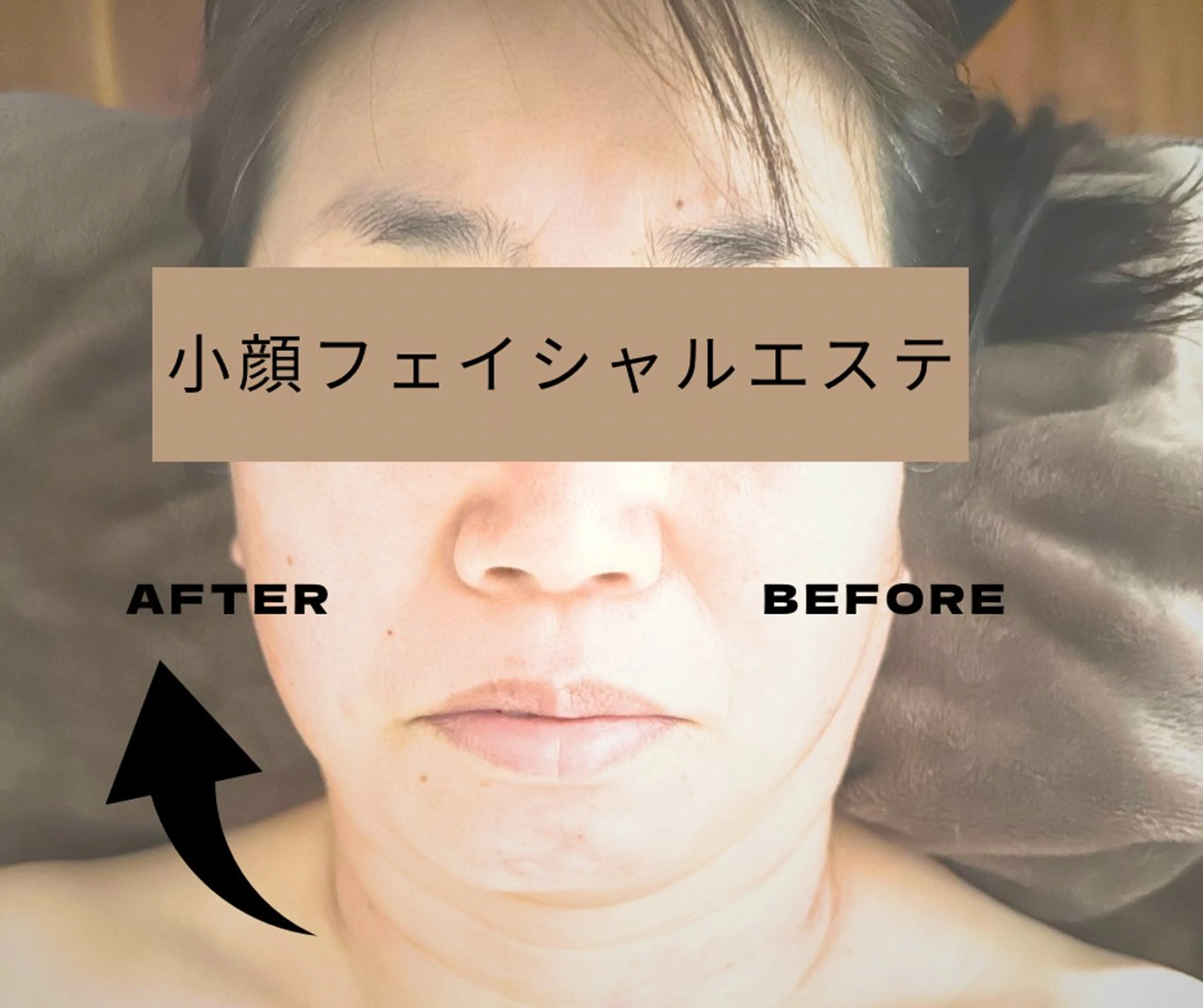 (小顔)たるみ・引き締め小顔コースの写真