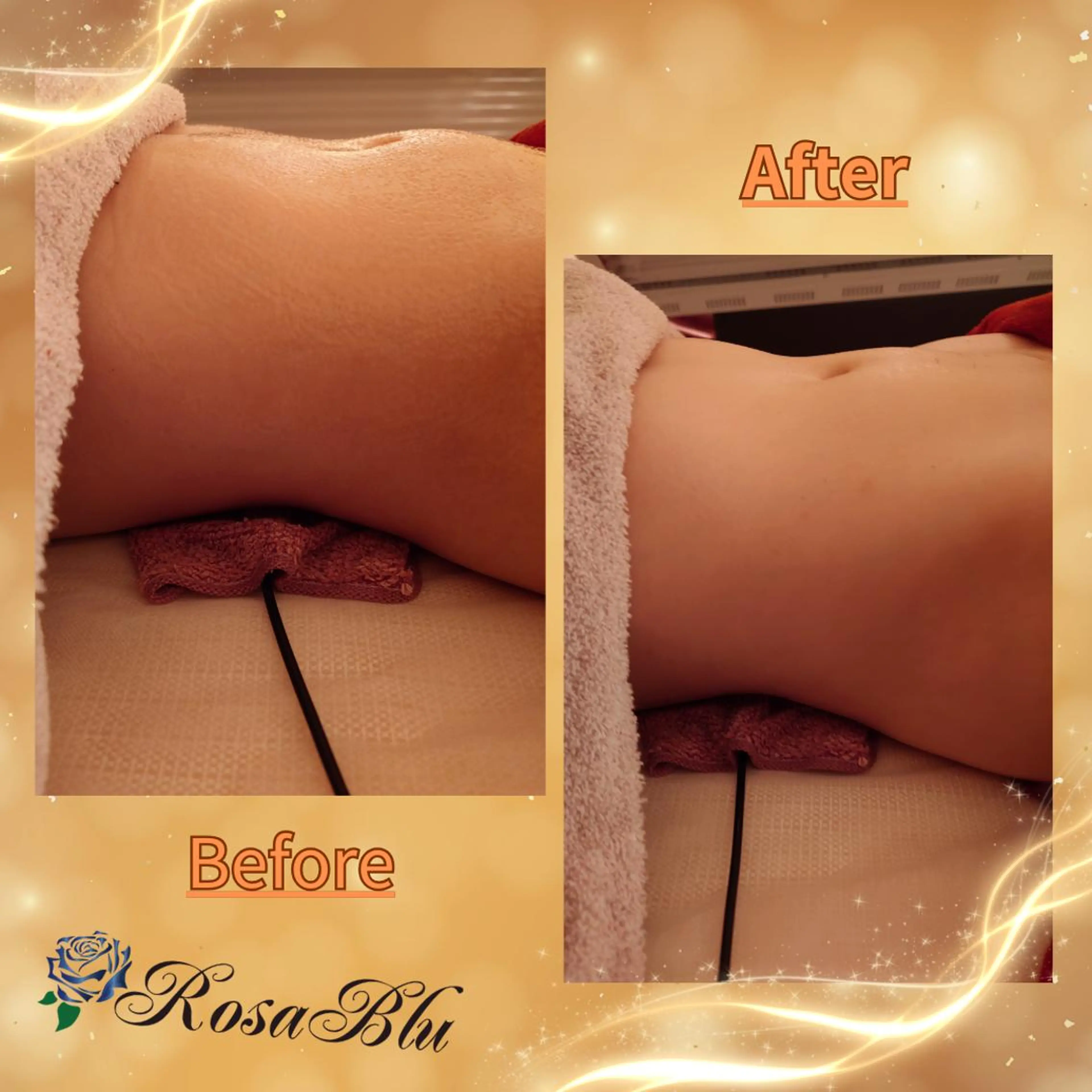 【上半身60分コース】背中＆お腹の写真