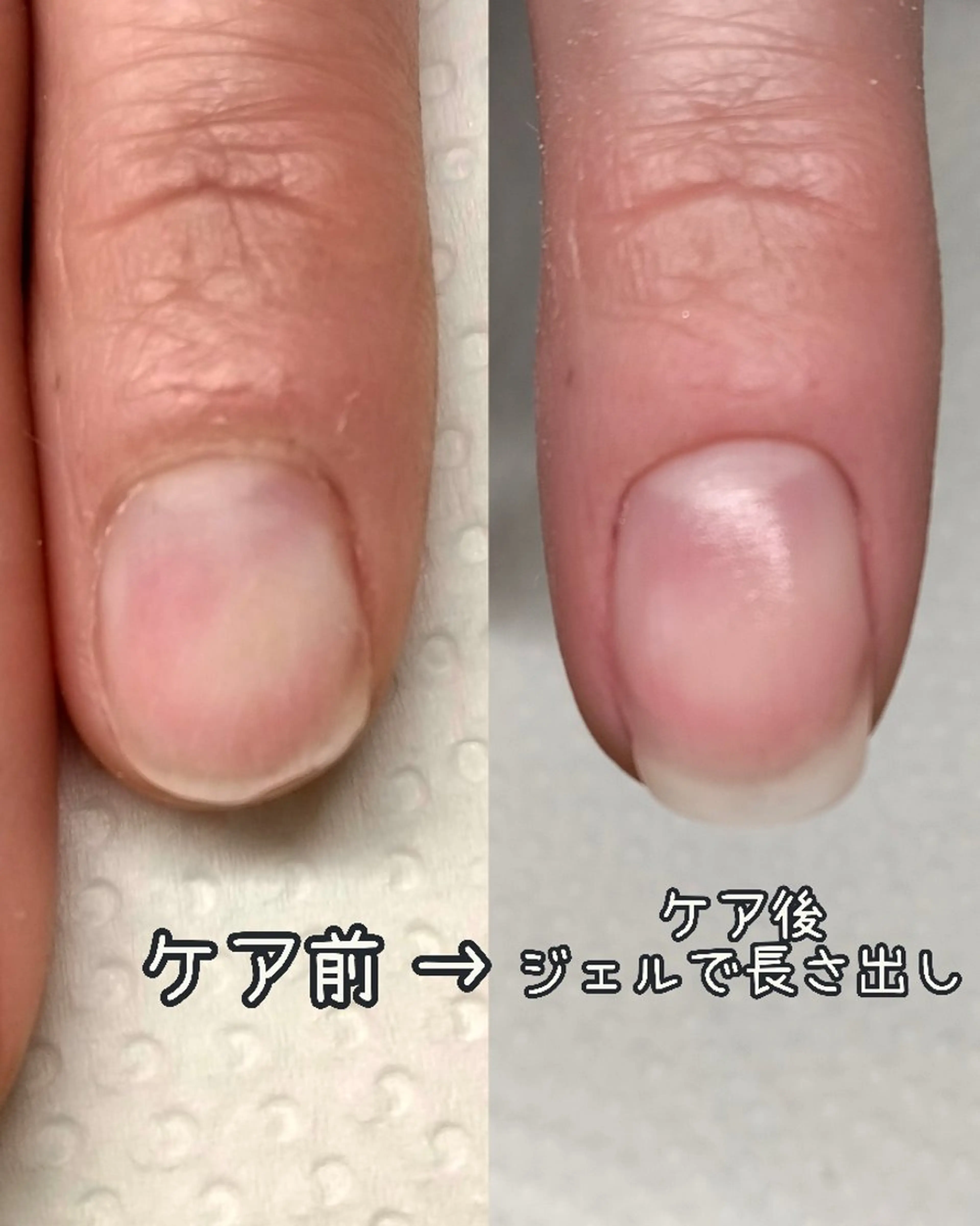 【オプション】ジェルでの自然な長さ出し(1本)の写真