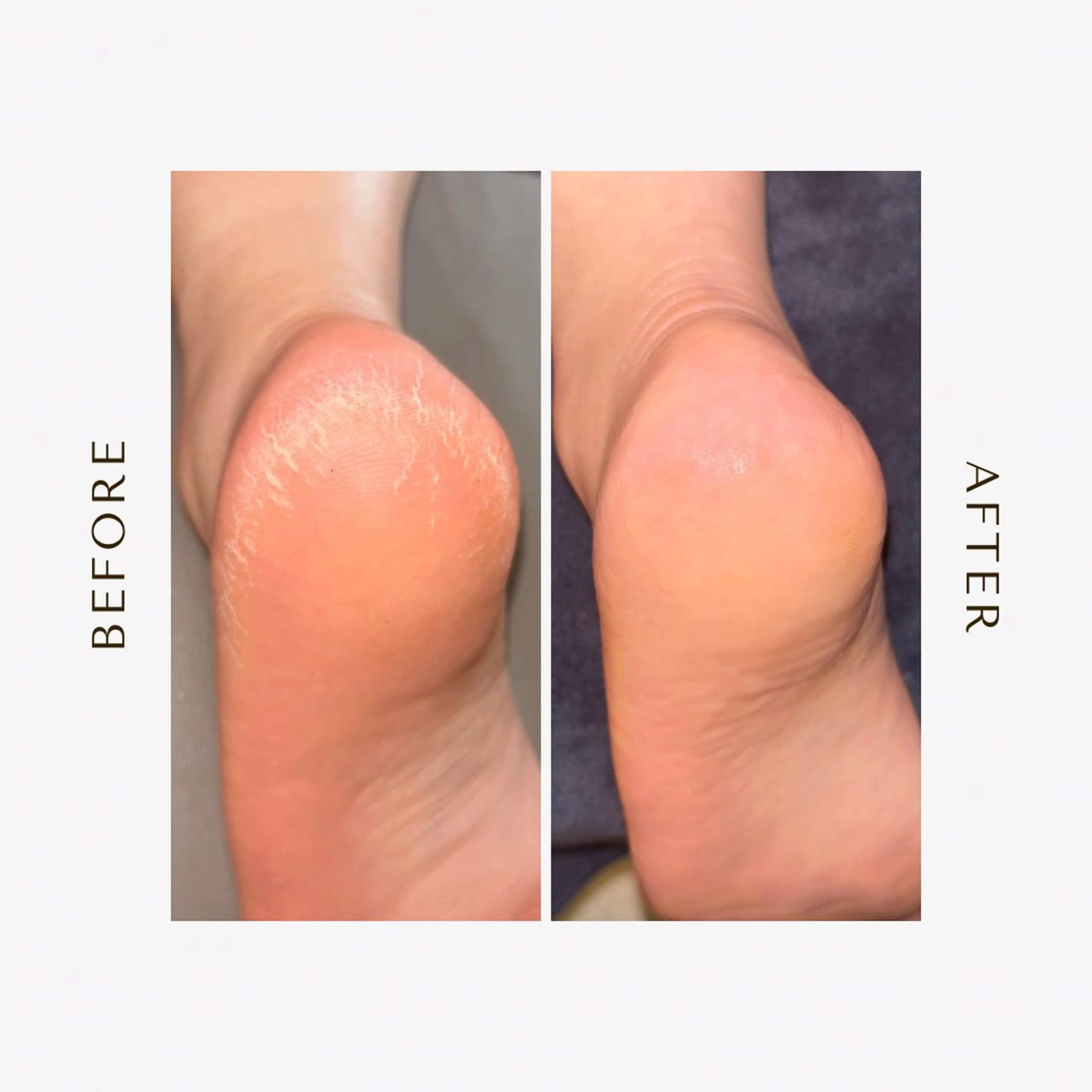 【辻堂海岸店or鵠沼海岸店】フット角質ケア＋フットトリートメント🦶✨の写真