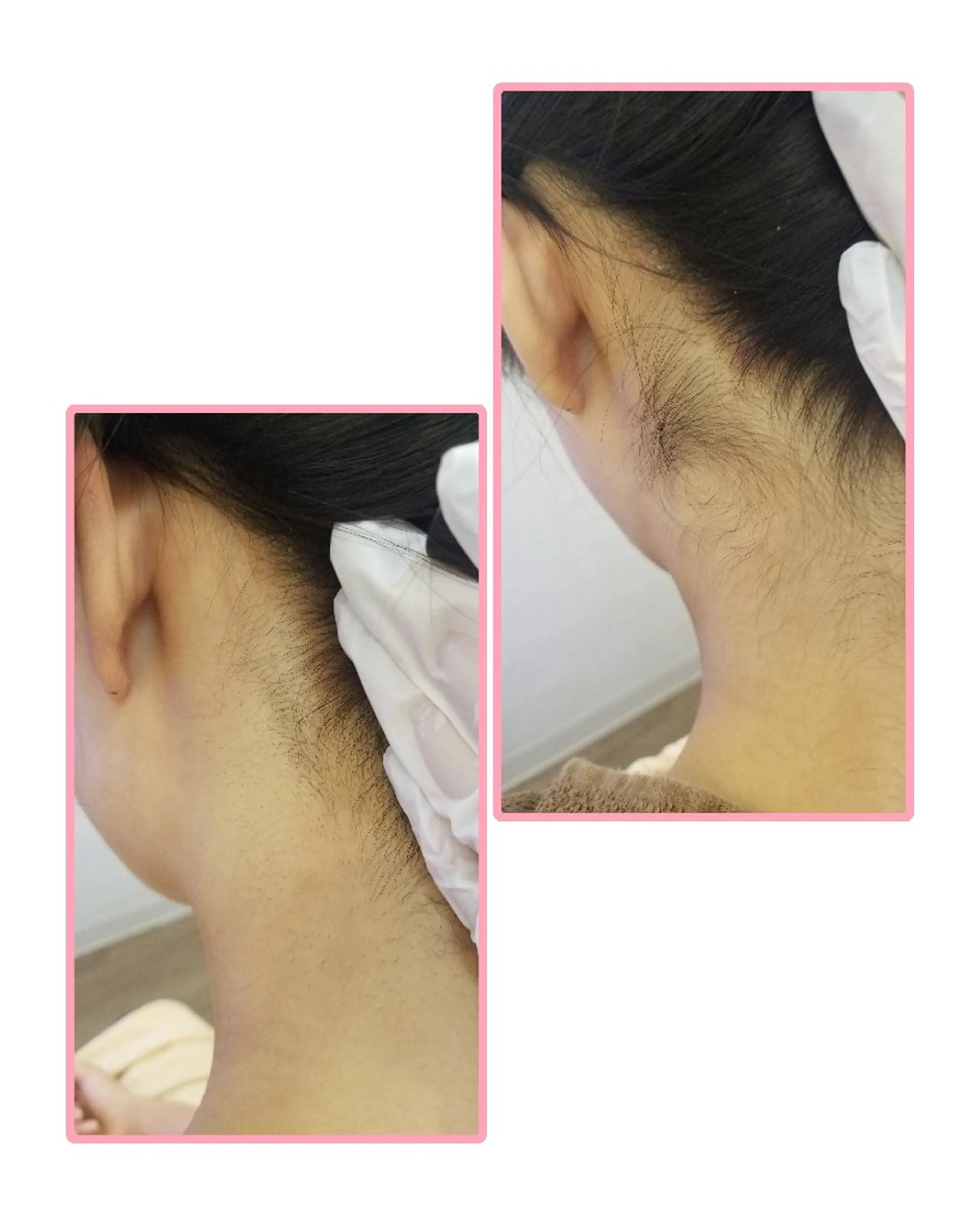 脱毛 salonde ReGodのエステ・リラクイメージ