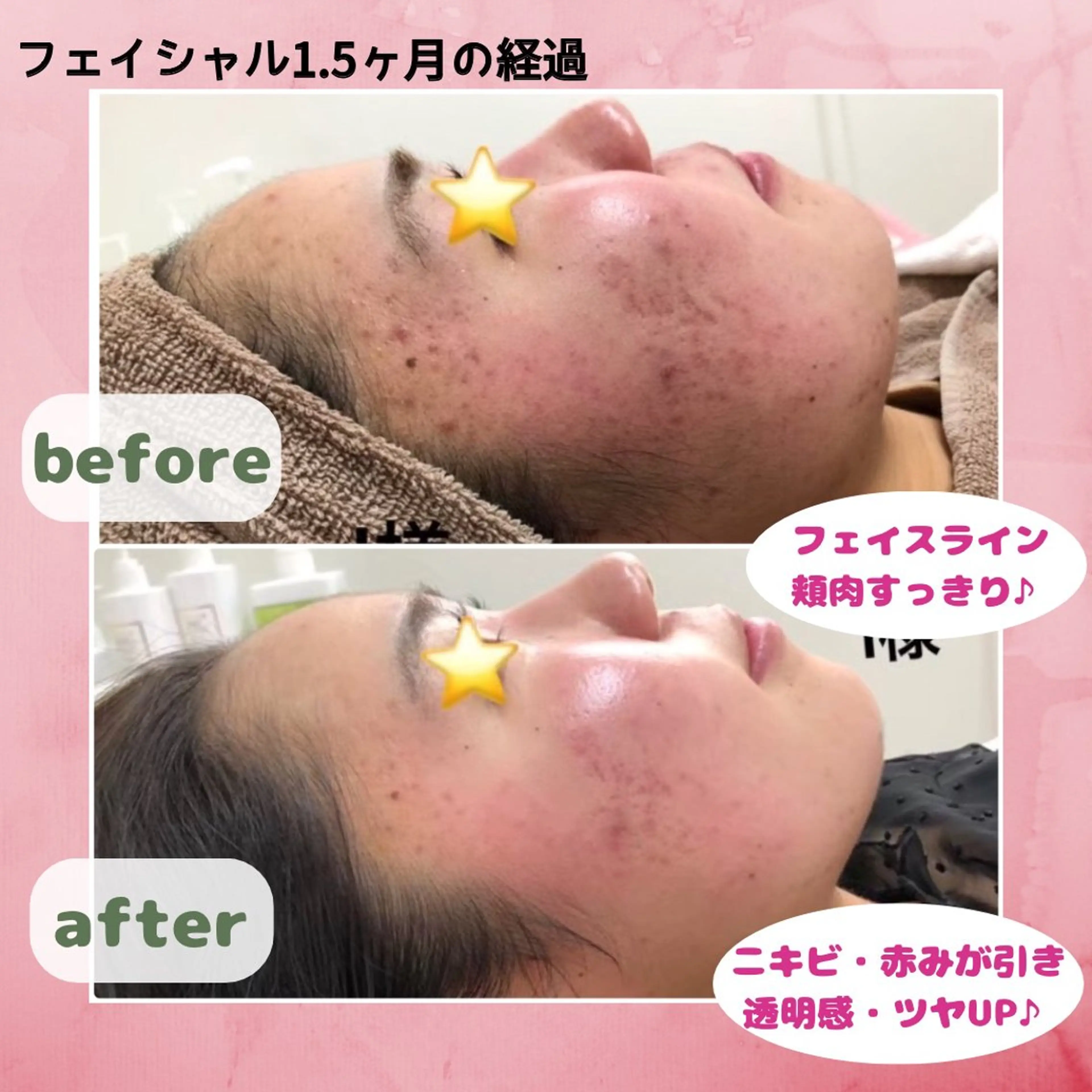 エステ Prima栄店所属・Prima 〜プリマ栄店〜のエステ・リラクイメージ