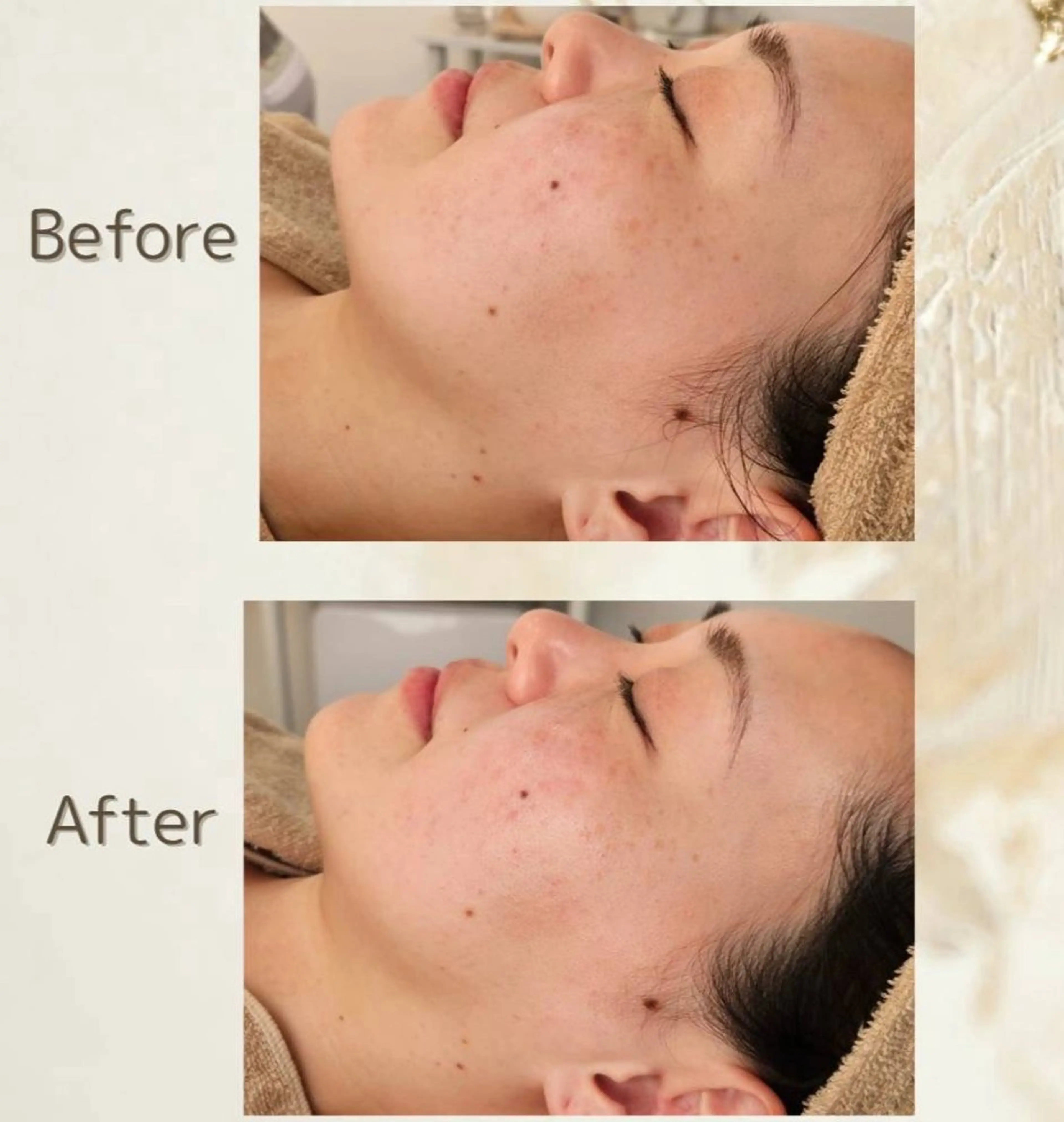 【初回】ツヤ肌フェイスシェービングの写真