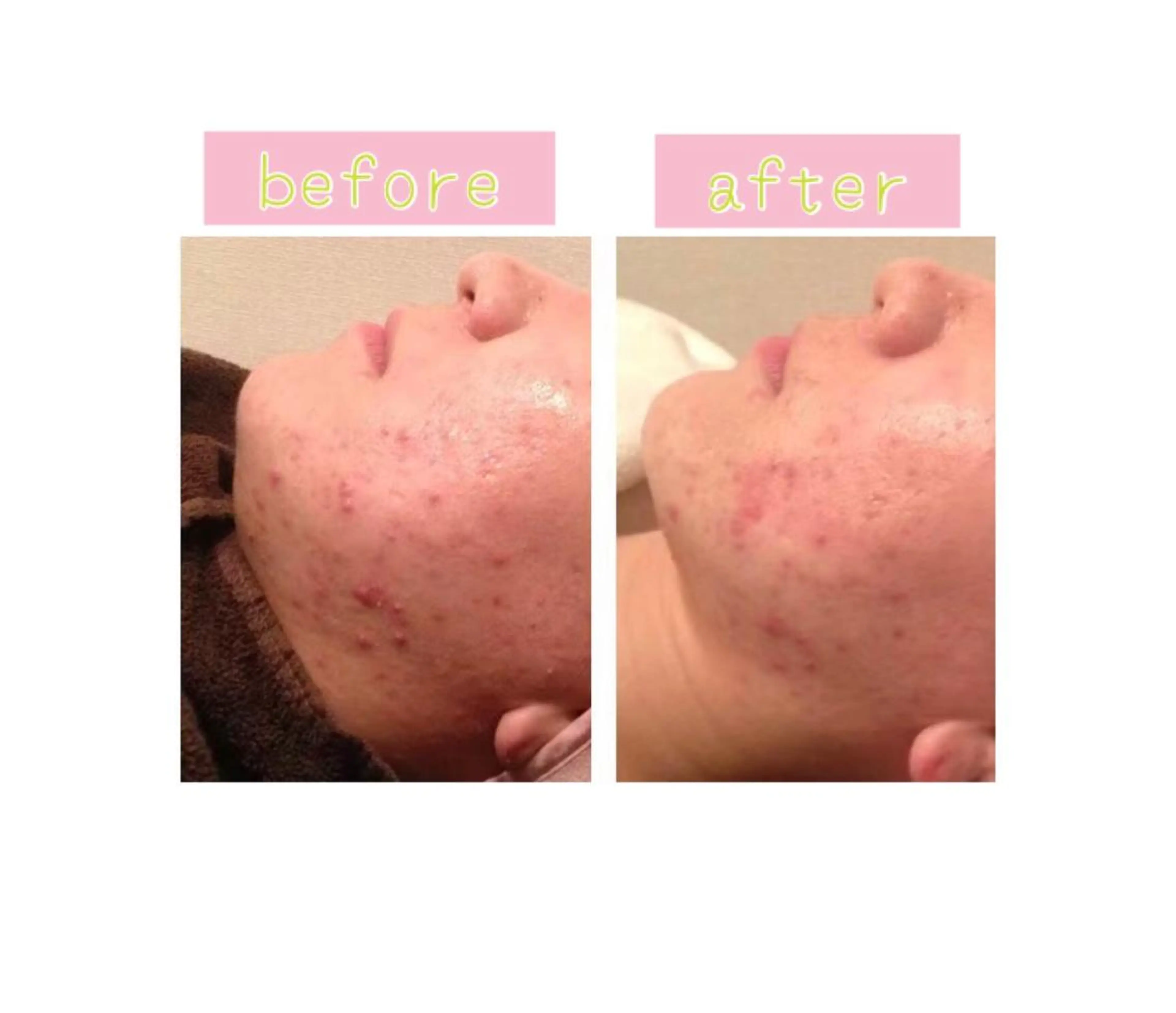 エステ 癒し腸もみサロン シャユーム　ゆきなのエステ・リラクイメージ