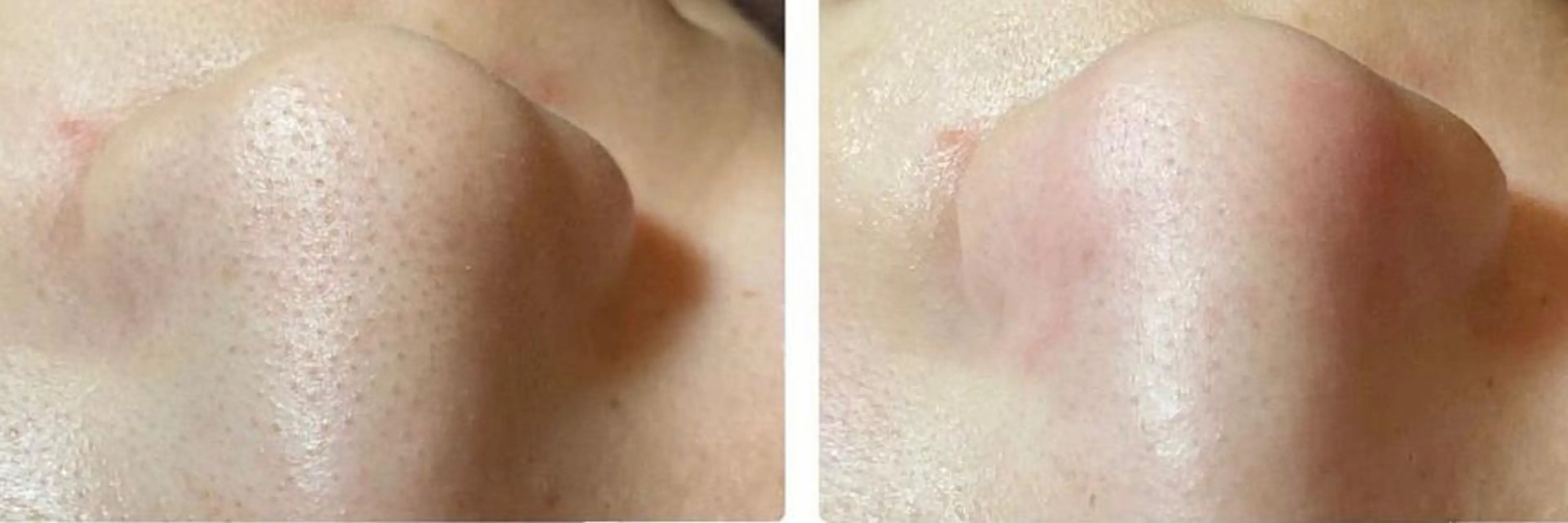 メンズ beauty salonnのエステ・リラクイメージ