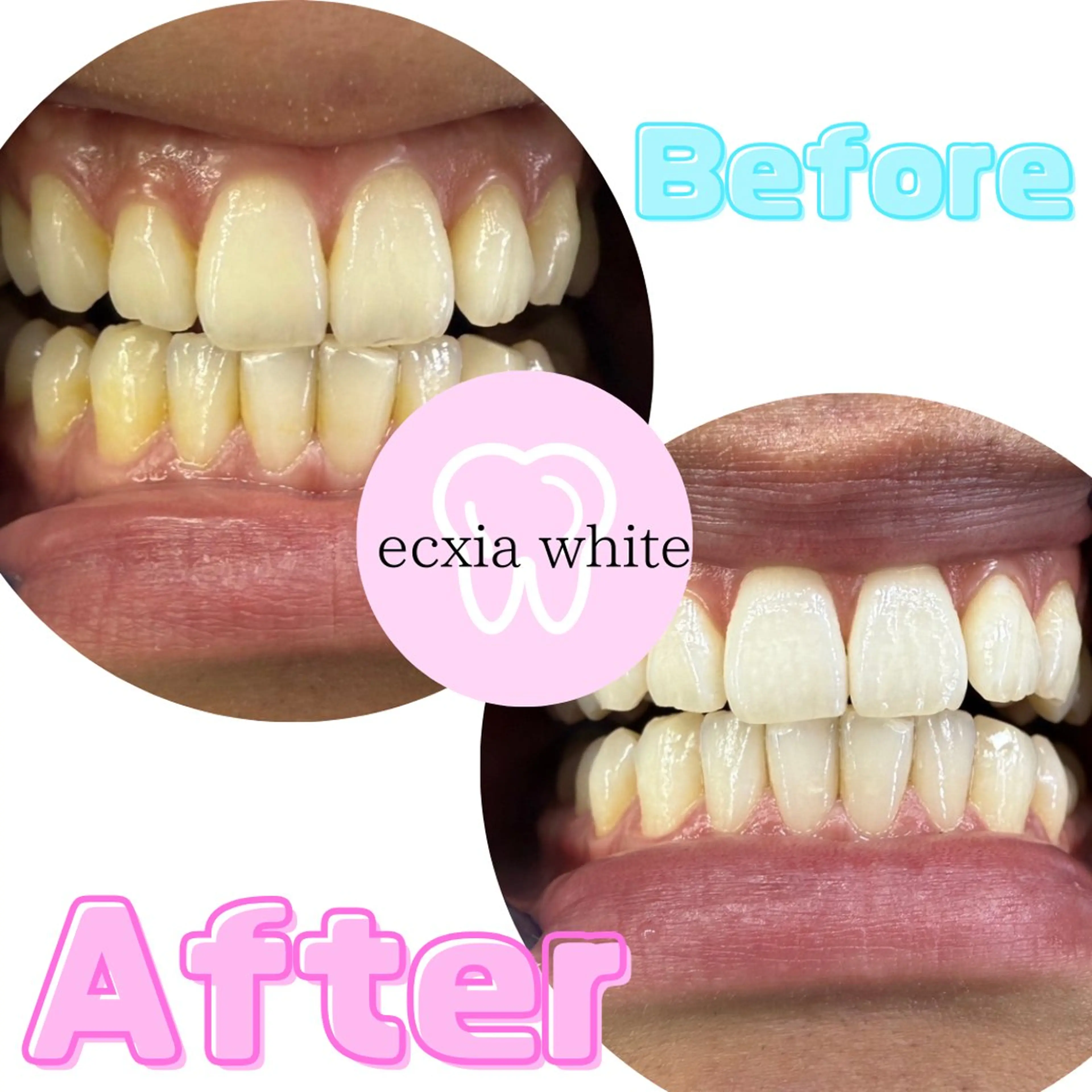 その他 エクシアホワイト福岡六本松所属・喜多 美佳のその他イメージ