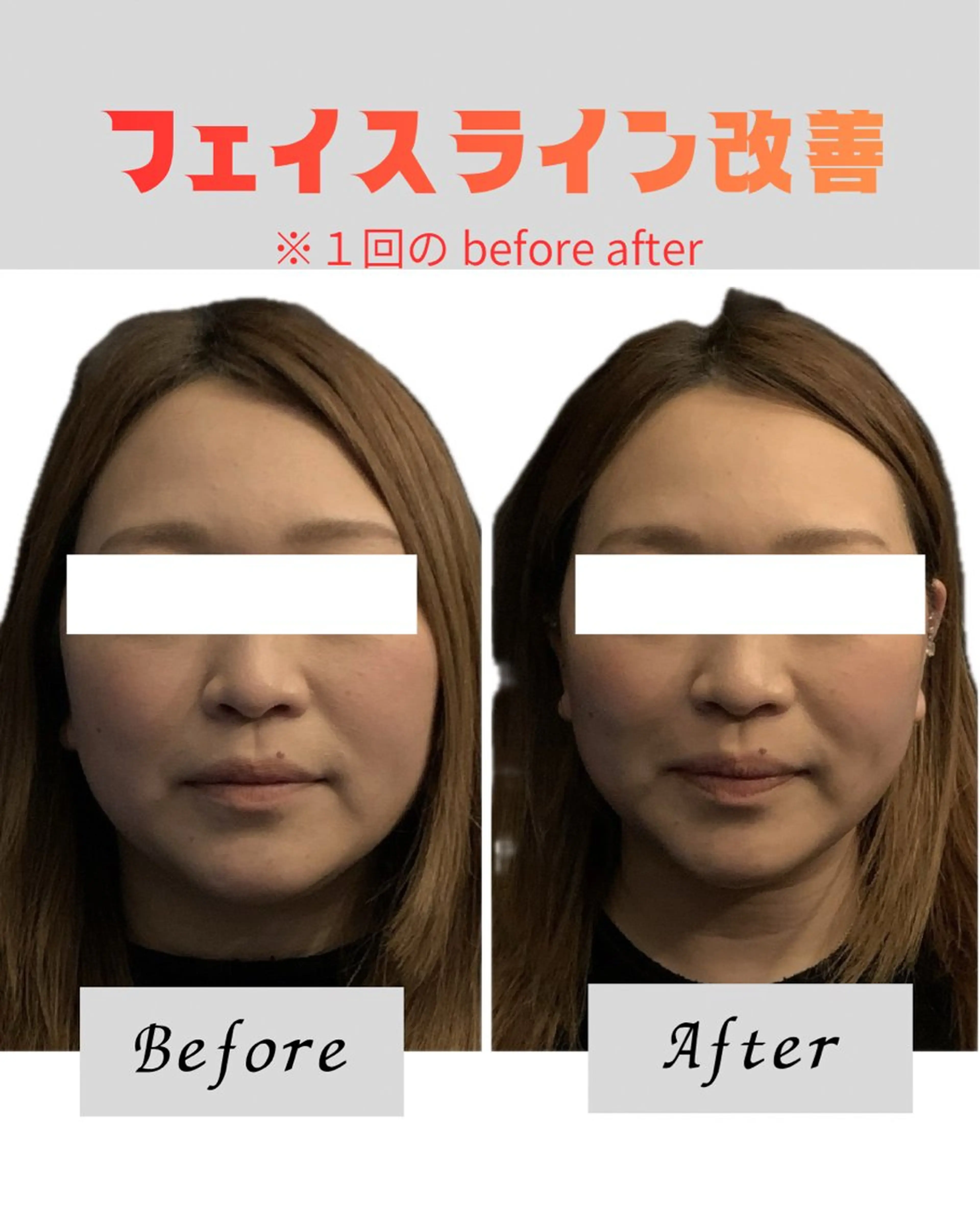 Re mのエステ・リラクイメージ