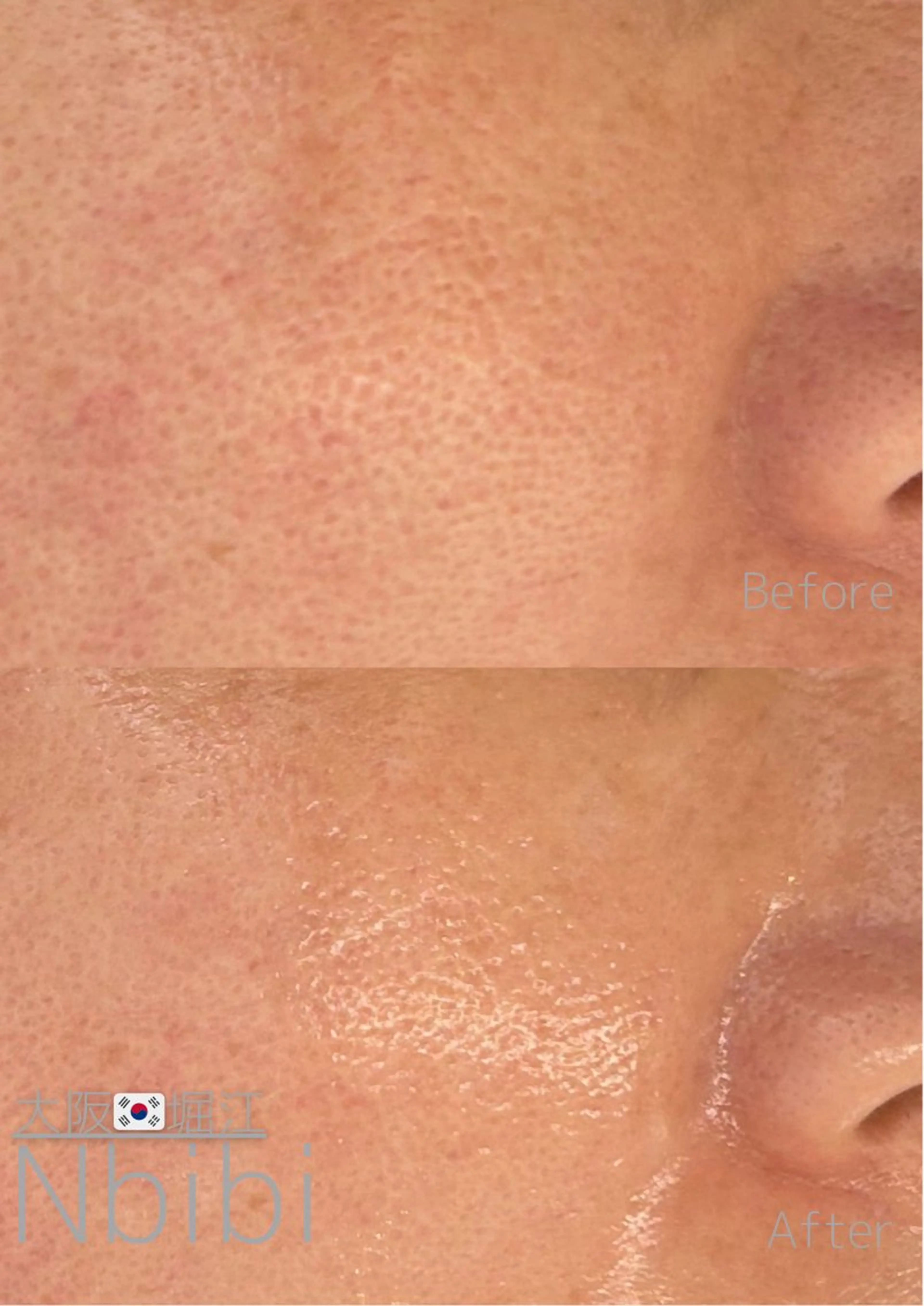 エステ 韓国🇰🇷価格 サロン_Nbibiのエステ・リラクイメージ