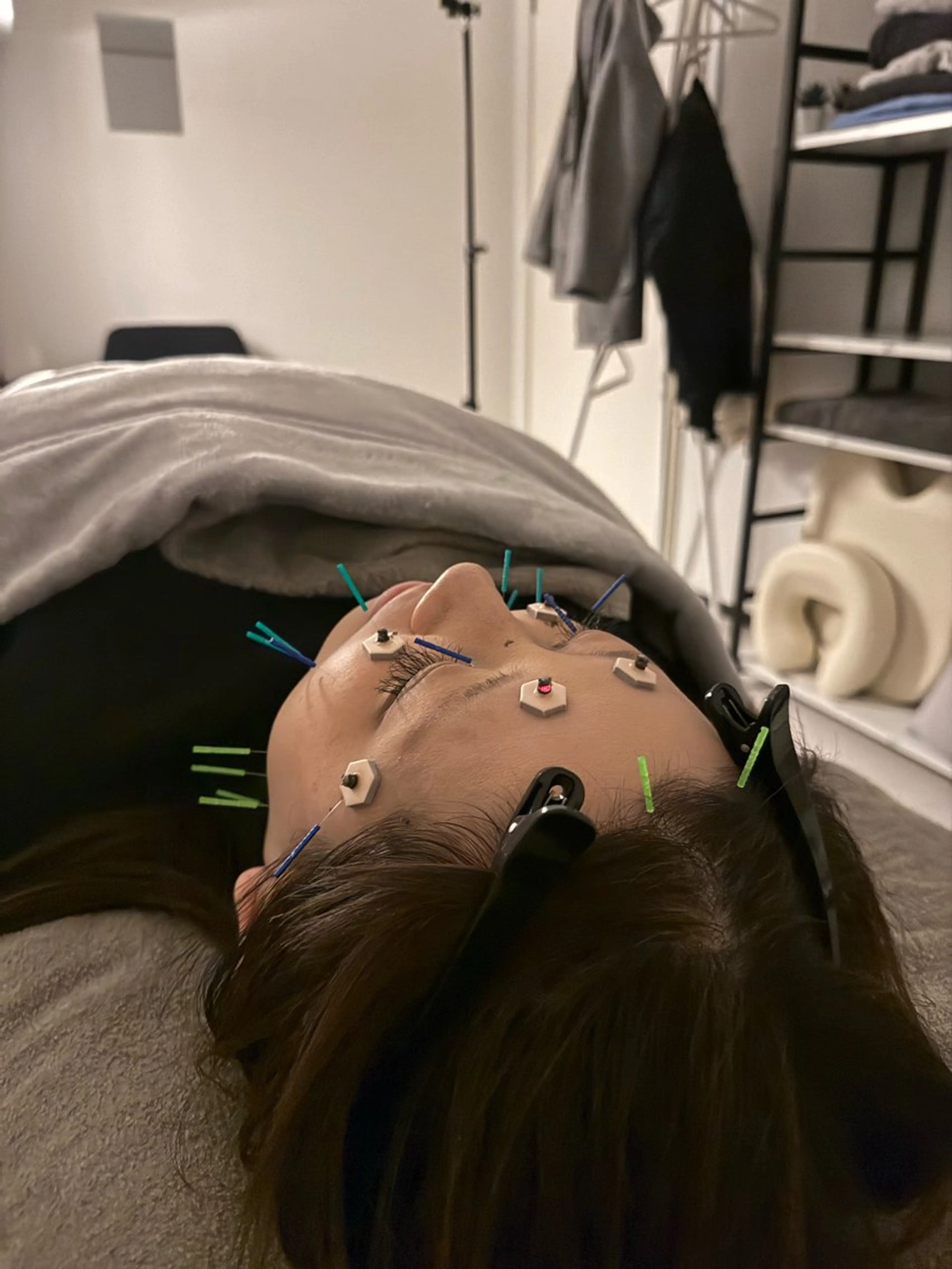 エステ リラク 美容鍼×小顔矯正 ×美容整体　浜川泰仁のエステ・リラクイメージ