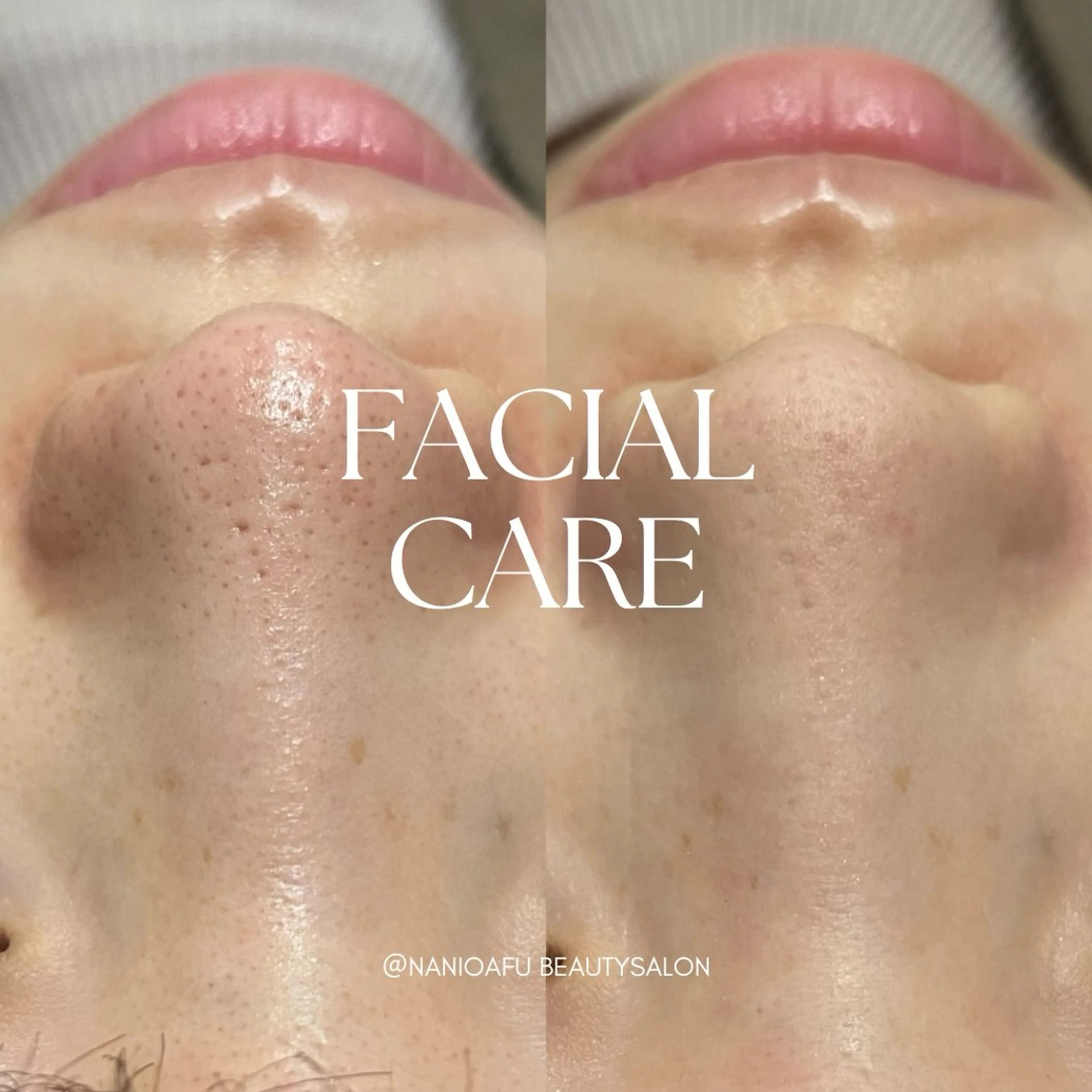 メンズ キッズ エステ リラク NANI OAFU所属・NANIOAFU [なんば店］のその他イメージ