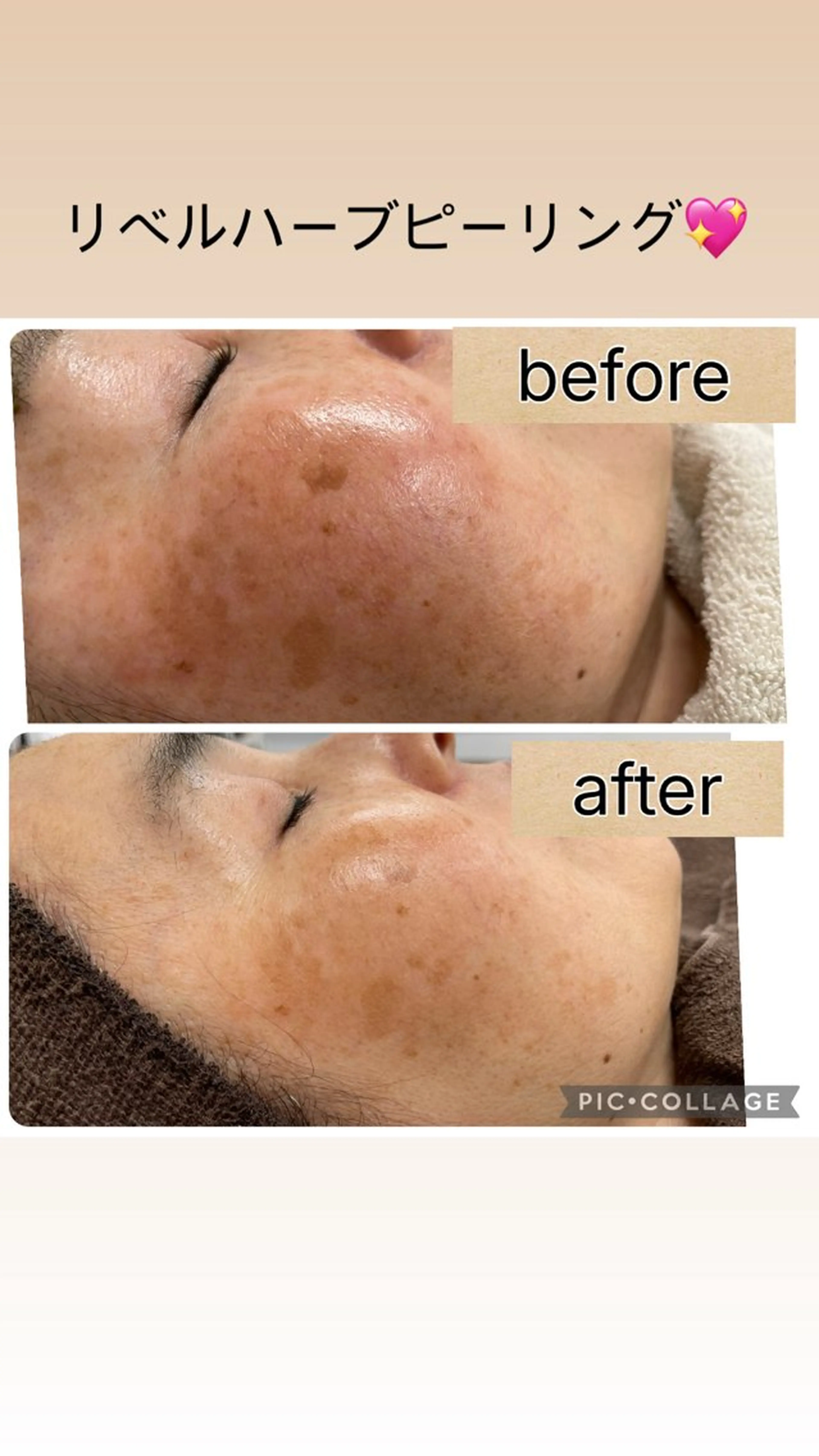 撮影モデル total beauty  salon RIRE所属・古川 弥生のエステ・リラクイメージ