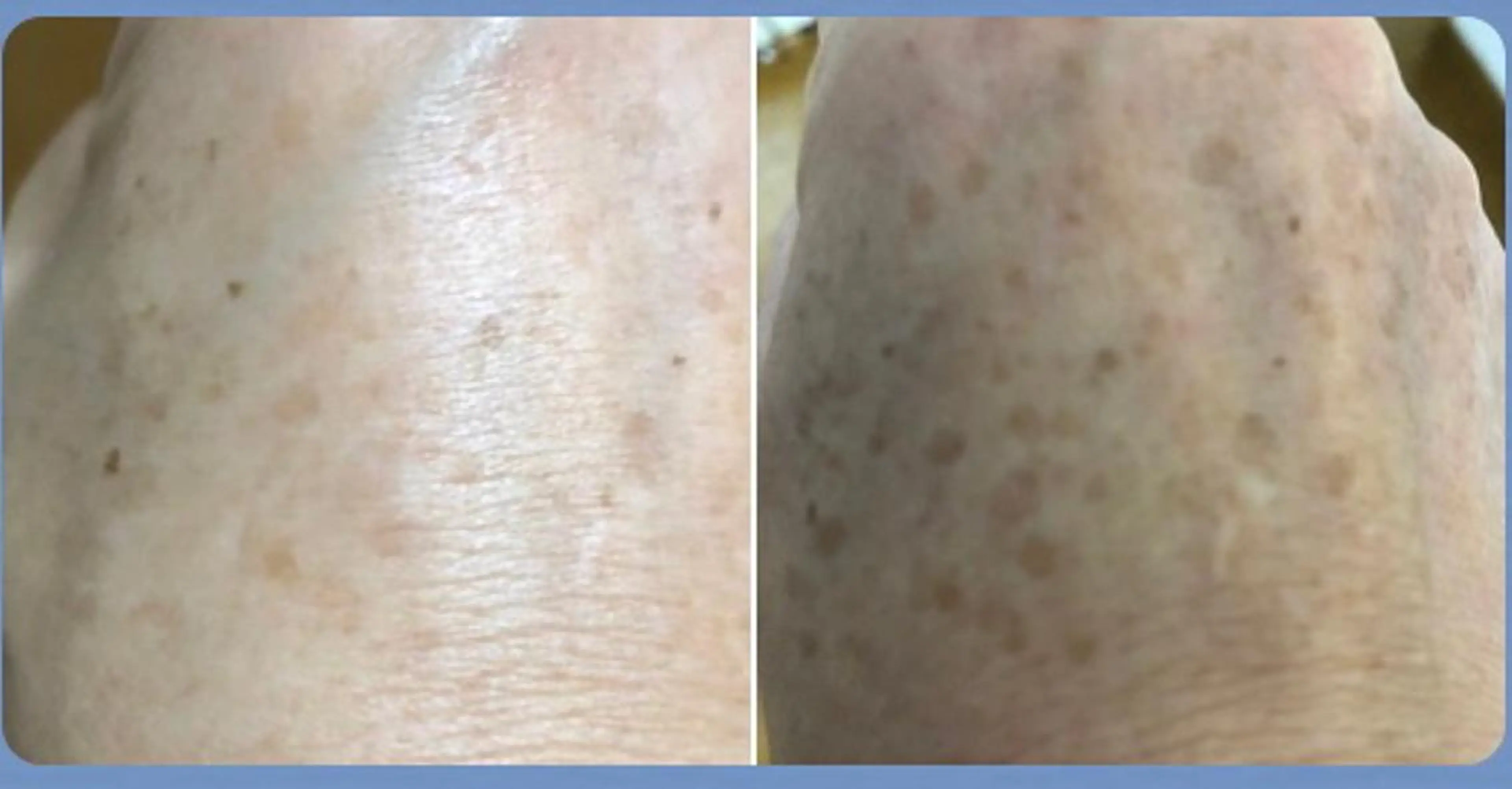 ARONA(アローナ)所属・ARONA ♡のエステ・リラクイメージ