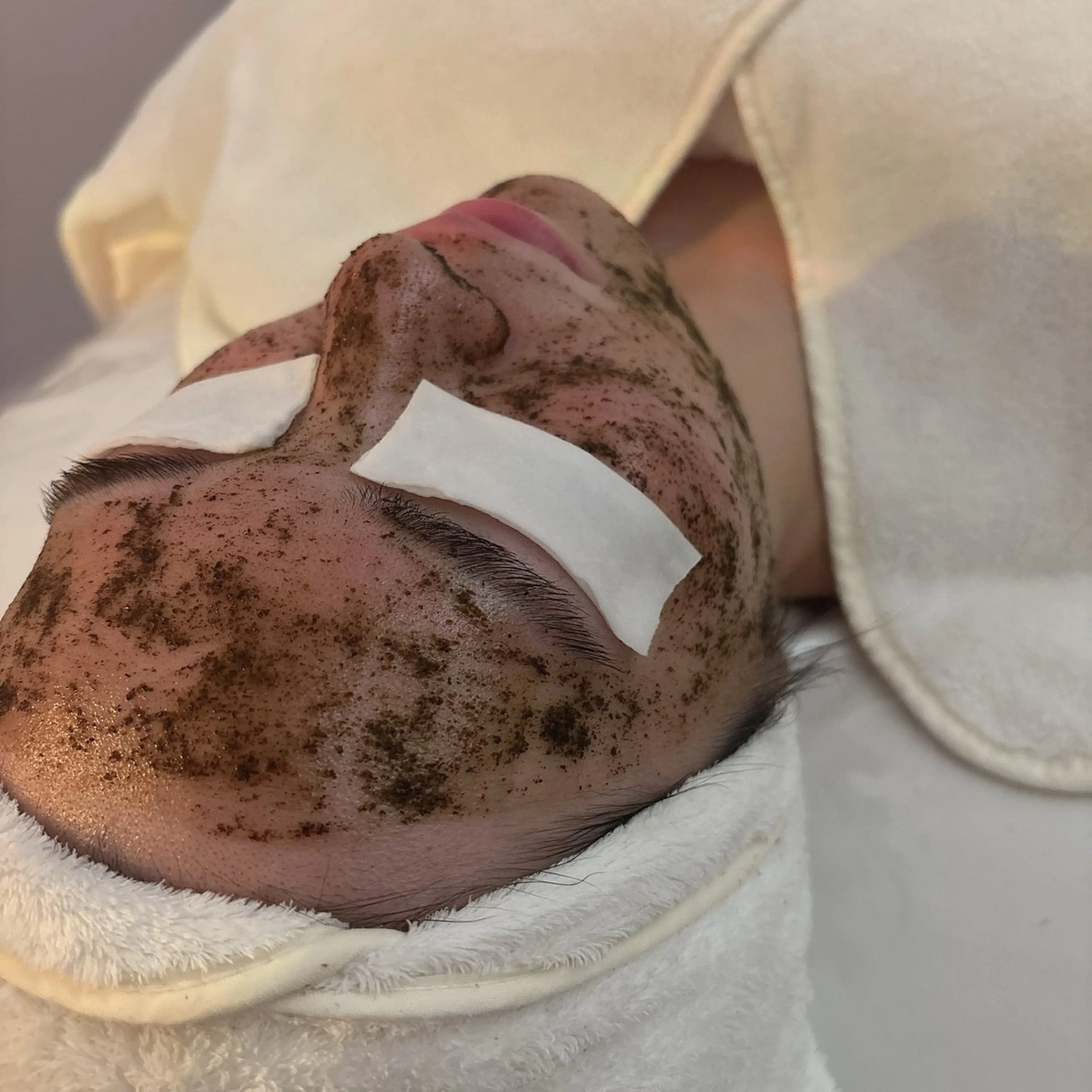 【今月大人気！】角質除去と栄養補給のWケアハーブピーリング★艶が戻る極上たまご肌作り🥚BIOPHYTO(ビオフィート)の写真