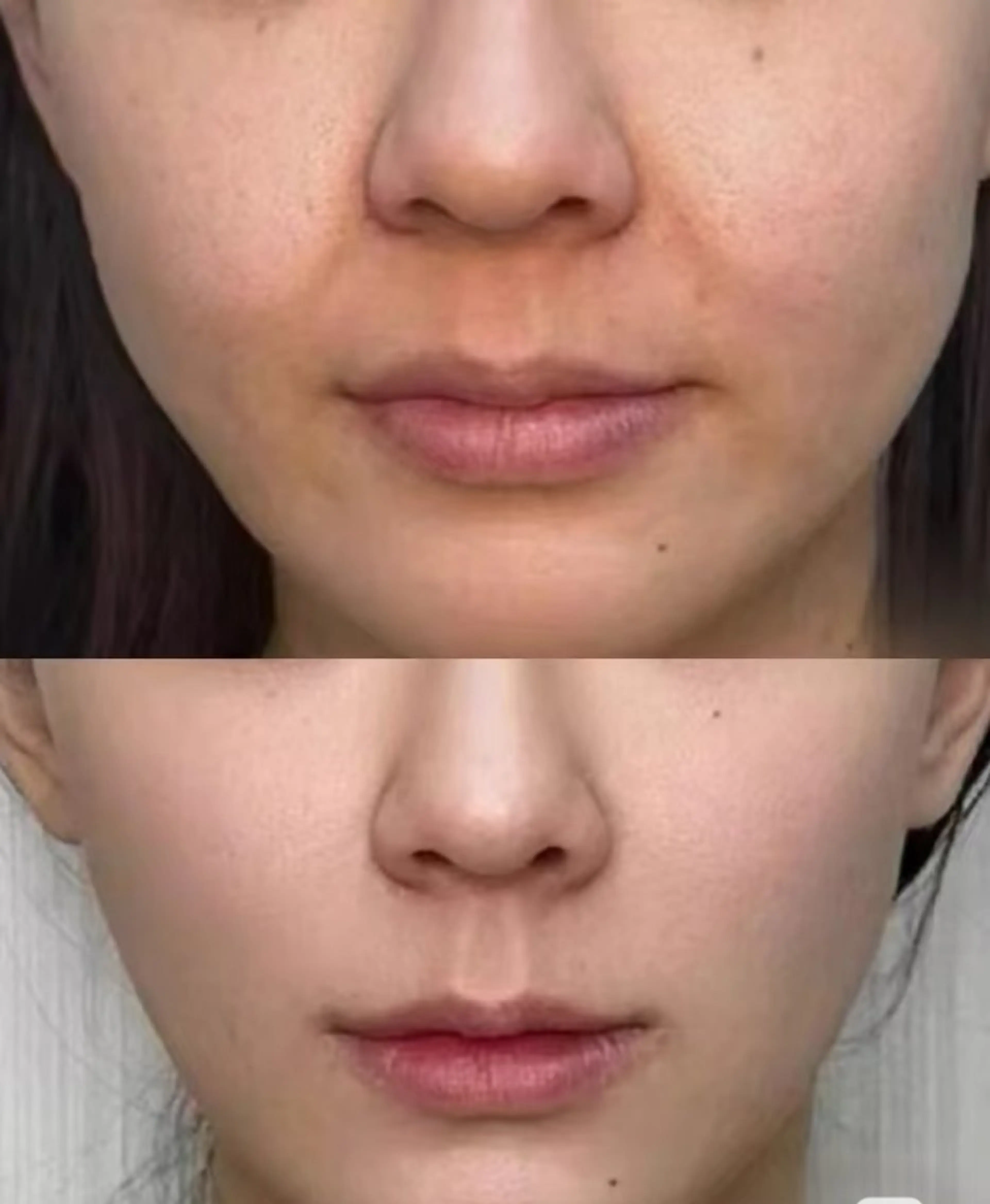 マツエク・マツパ 結婚式・ブライダル aliaハイフ&水光ジェットサロン所属・aliaハーブ水光店 エステティシャン募集のエステ・リラクイメージ