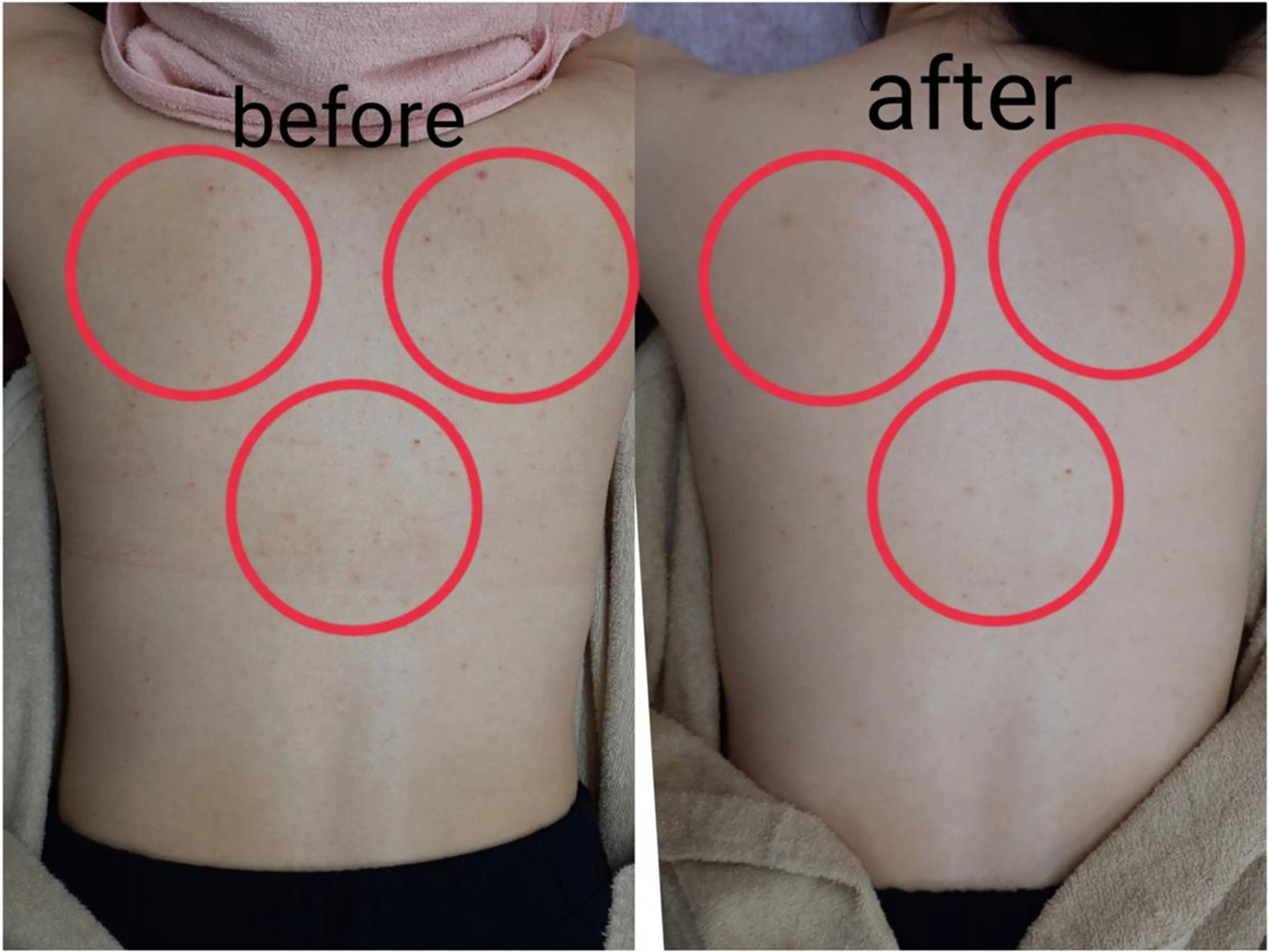 肌ケア＆毛穴洗浄 Cheriのエステ・リラクイメージ