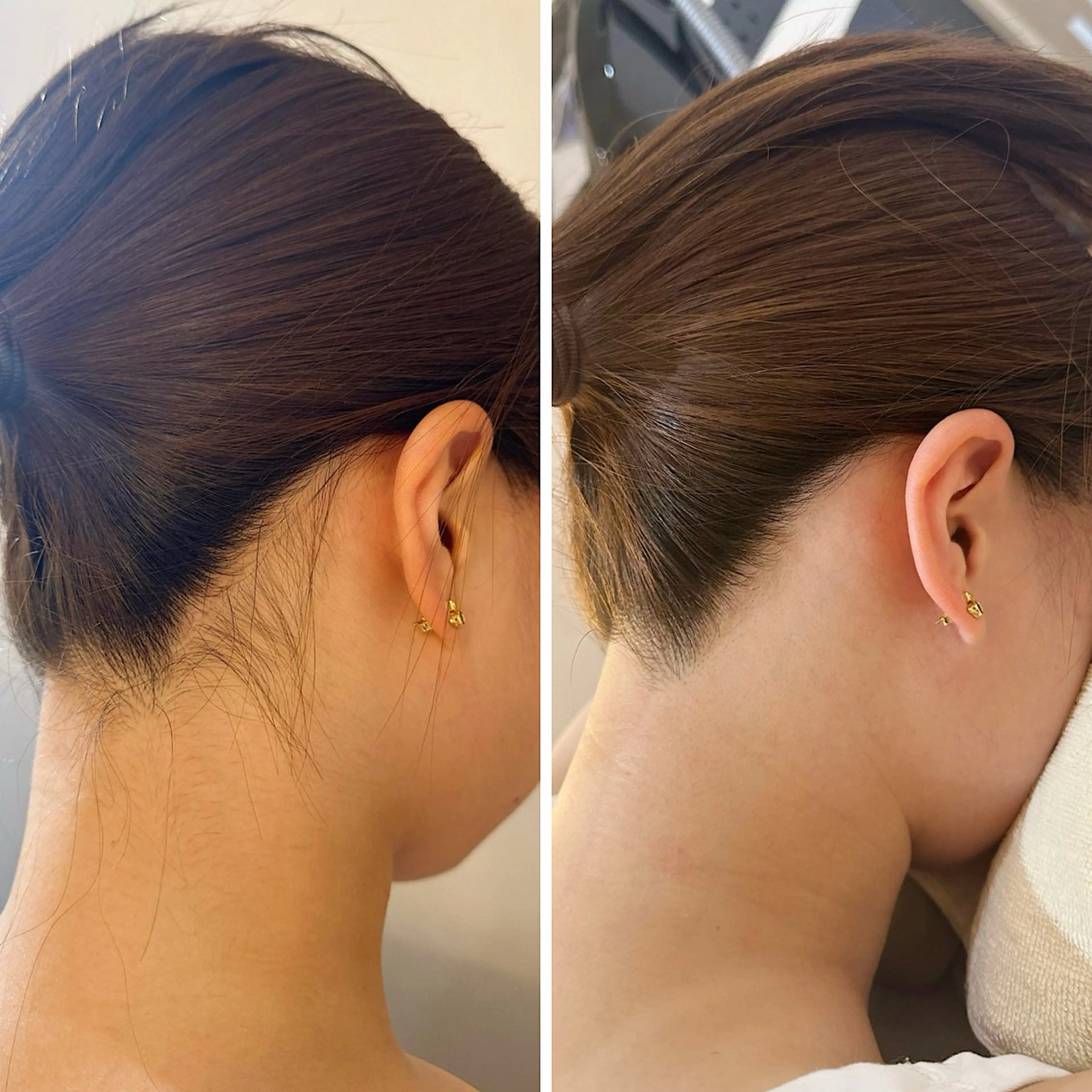 脱毛 うなじ脱毛/美肌脱毛 LABELのエステ・リラクイメージ