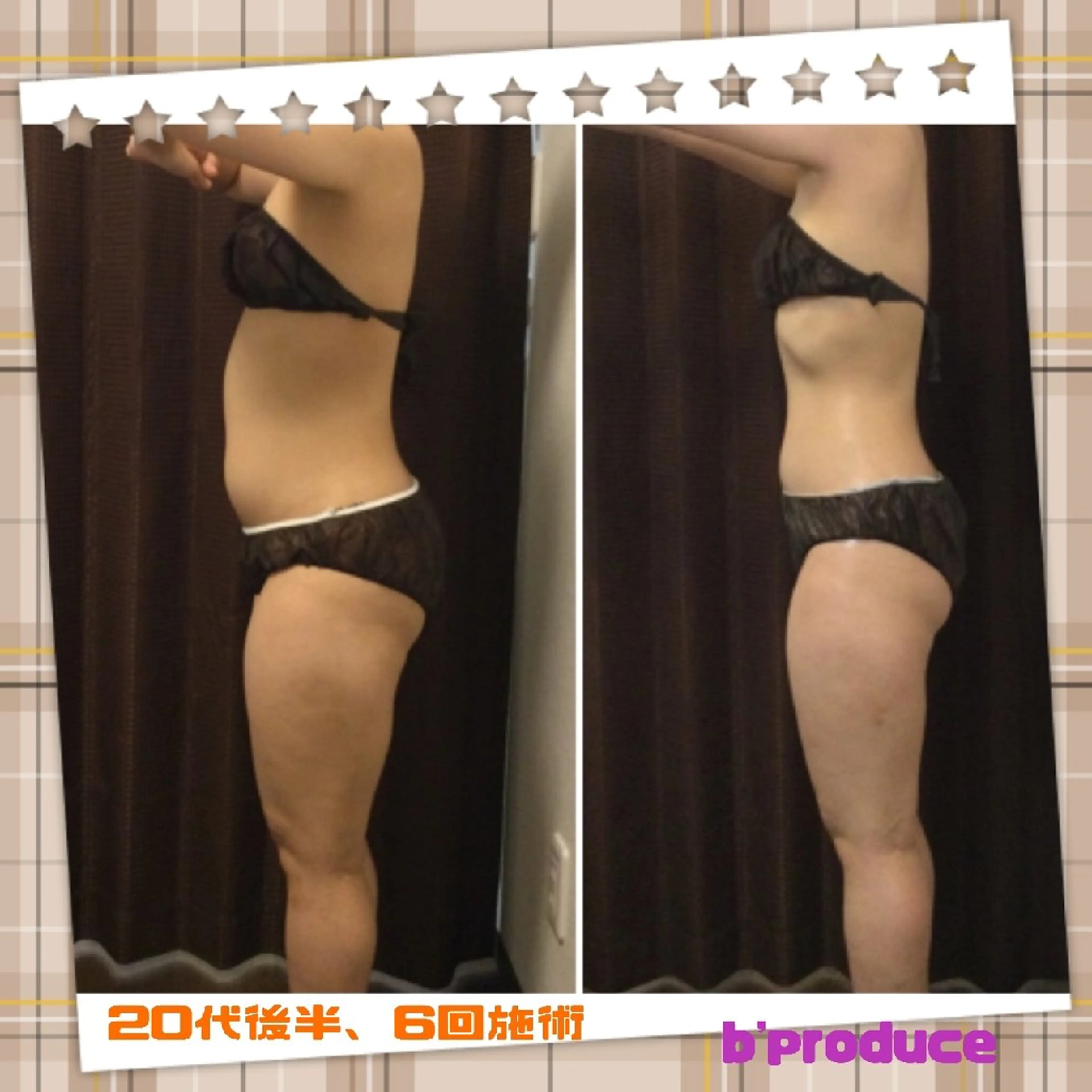 【美痩せ専門店】ビープロデュース豊田店所属・ビープロデュース 山下幸恵のエステ・リラクイメージ