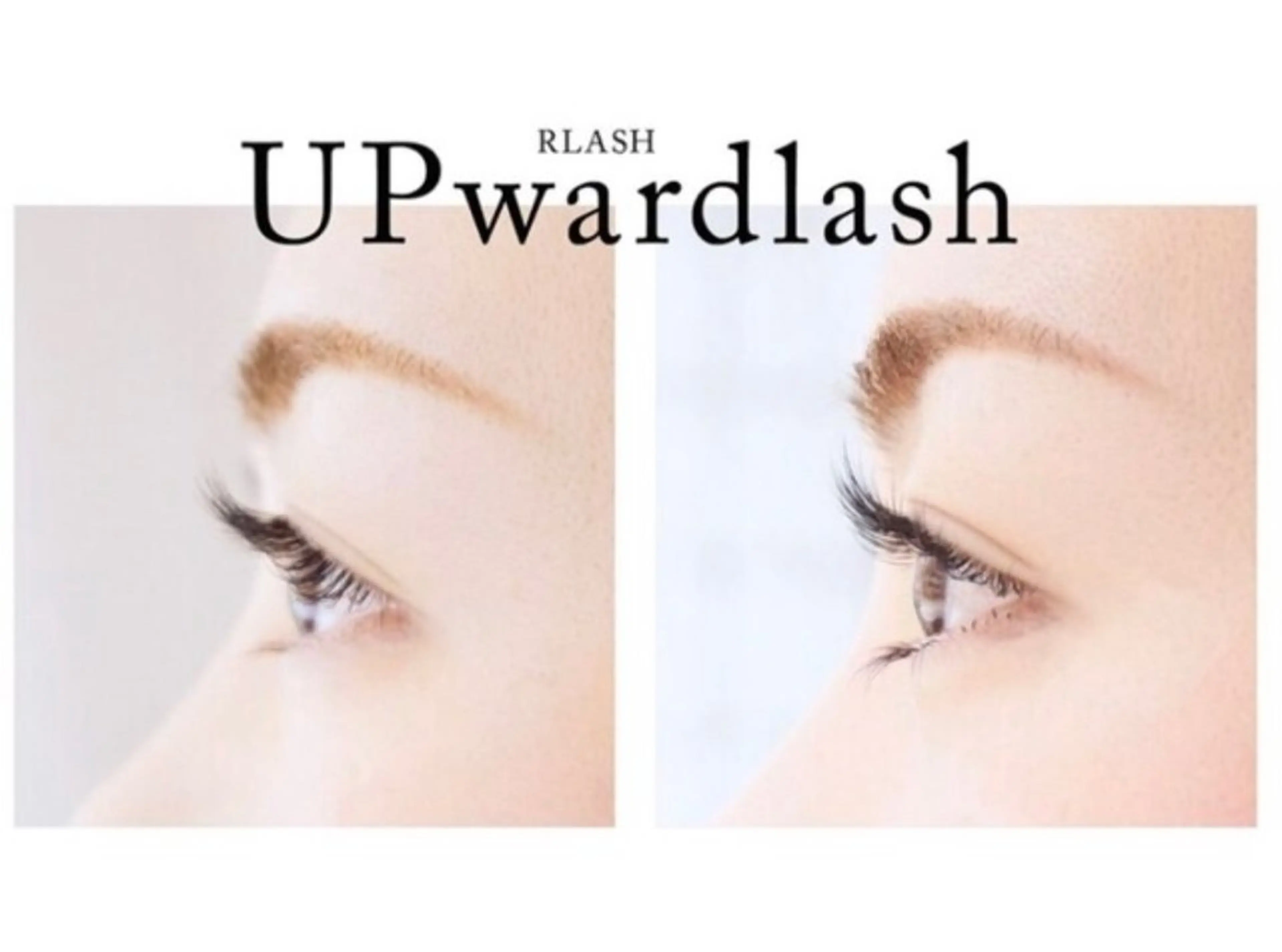 💙アップワードラッシュ100本の写真