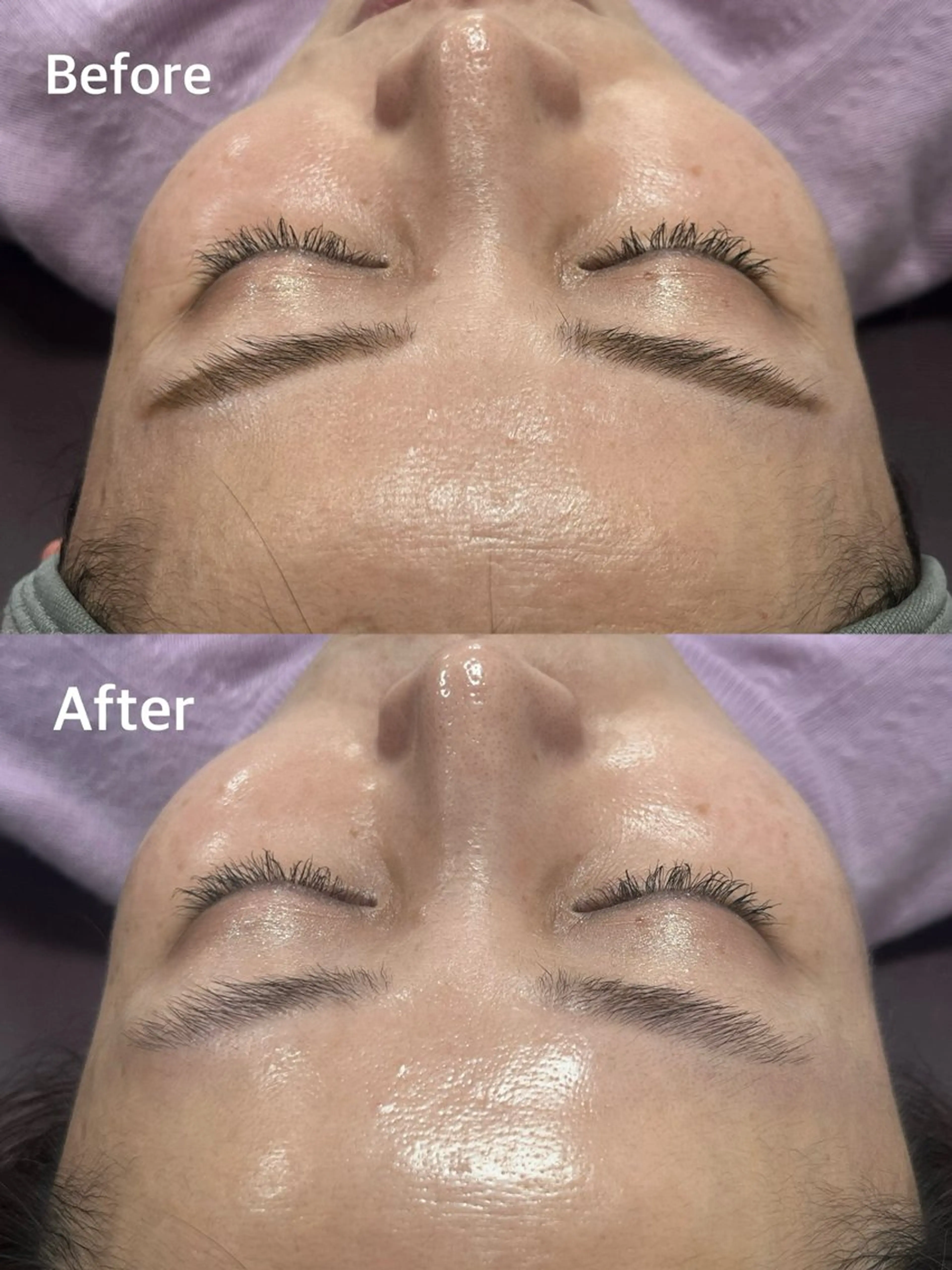 小顔専門看護師クリニカルサロンCOCO所属・小顔と美肌サロン クリニカルサロンココのエステ・リラクイメージ