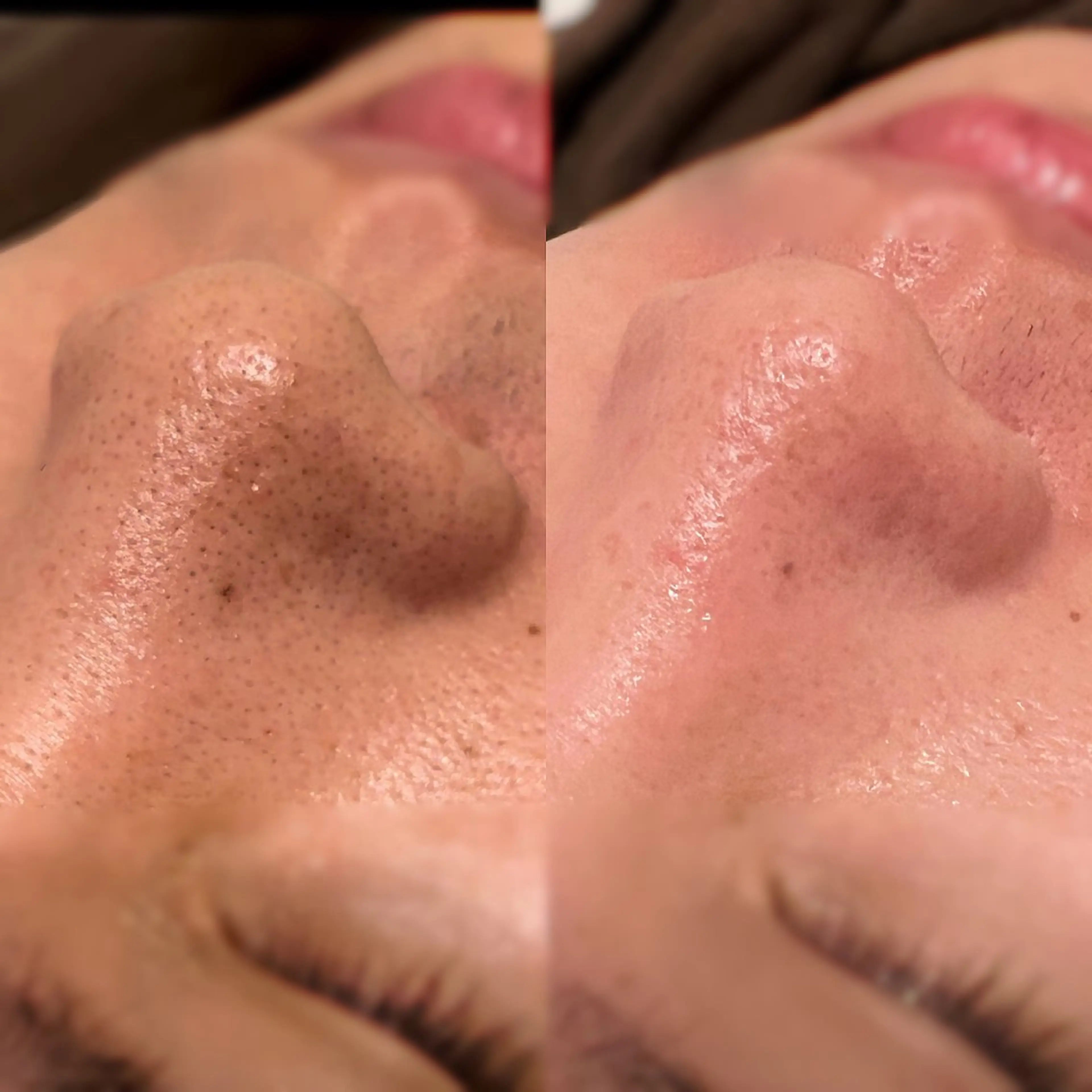 眉毛×肌質改善🫧 高岳/新栄町✨YUUの眉毛・アイブロウイメージ