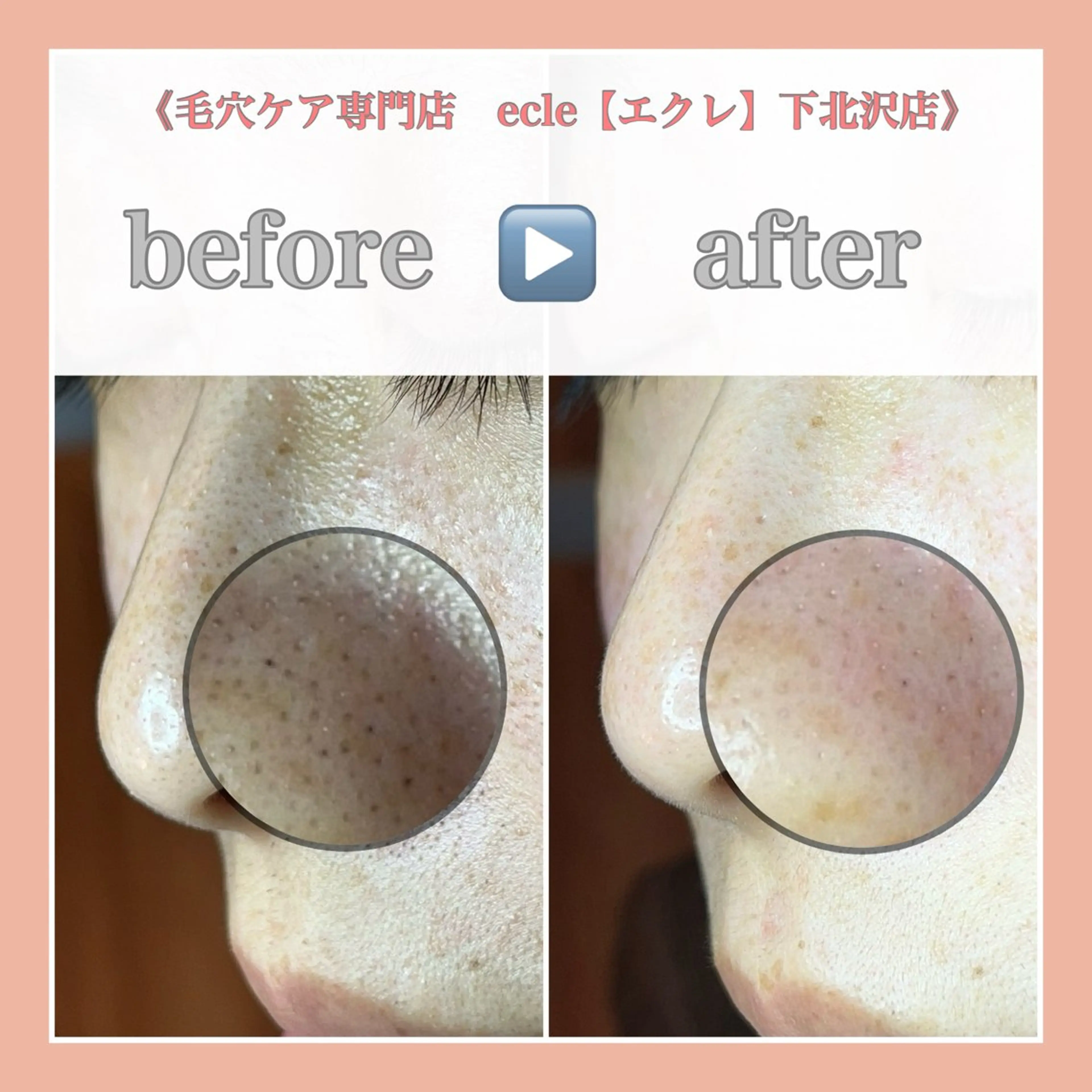 ecle ericaのエステ・リラクイメージ