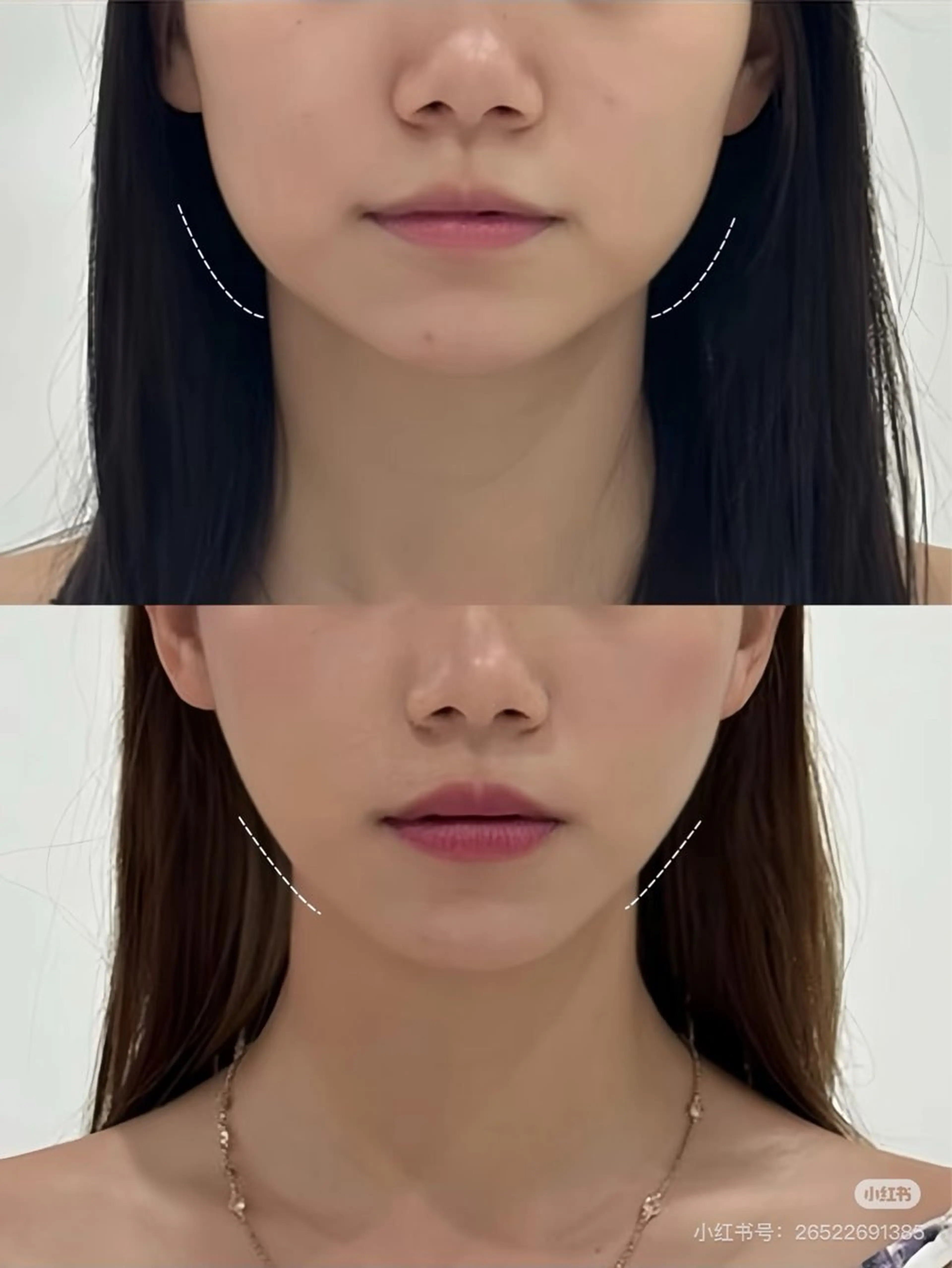 マツエク・マツパ エステ aliaハイフ&水光ジェットサロン所属・aliaハーブ水光店 エステティシャン募集のエステ・リラクイメージ