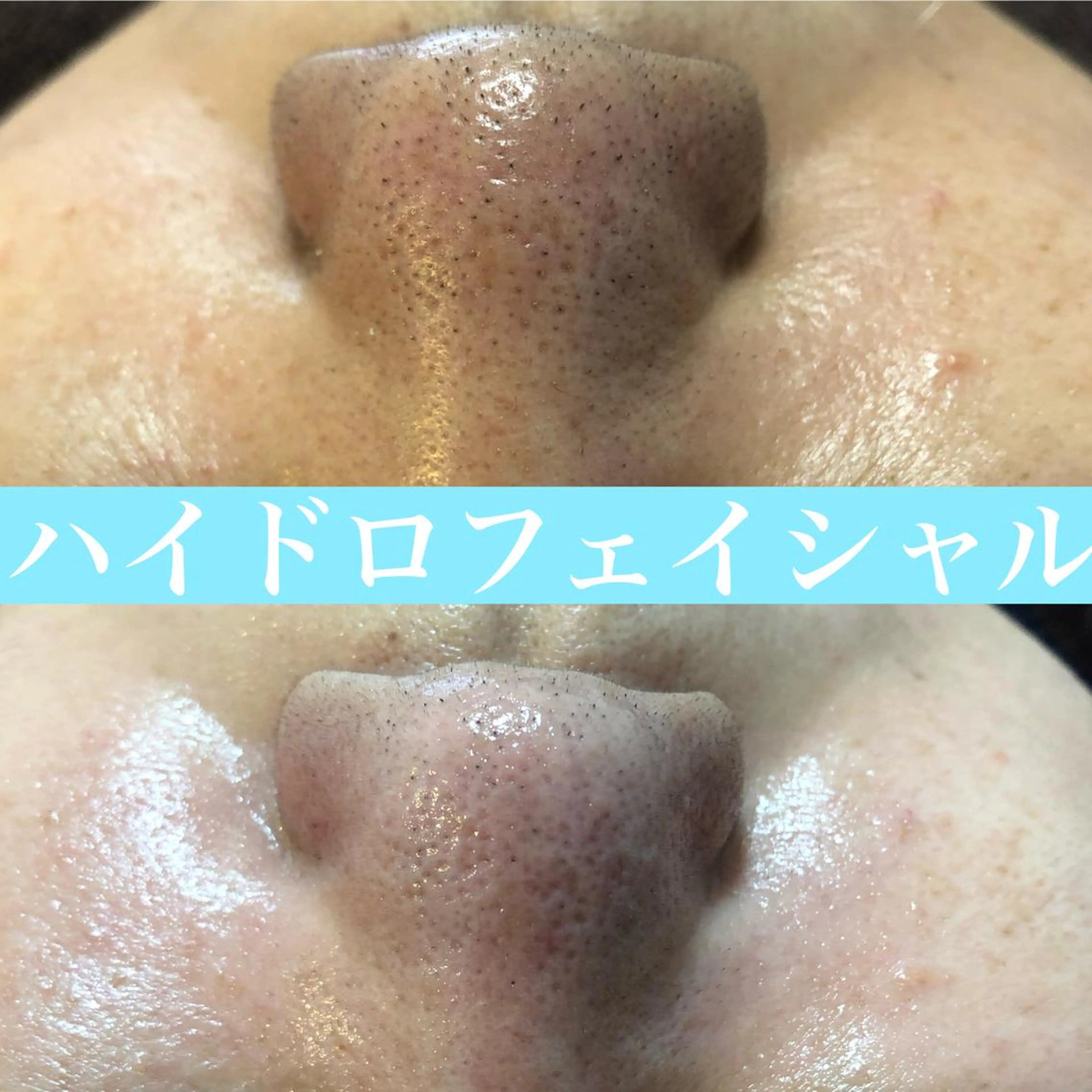 エステ 美肌脱毛と癒しのﾌﾟﾗｲﾍﾞｰﾄｻﾛﾝ。gratia~ｸﾞﾚｲﾃｨｱ~所属・gratia ~ｸﾞﾚｲﾃｨｱ~のエステ・リラクイメージ