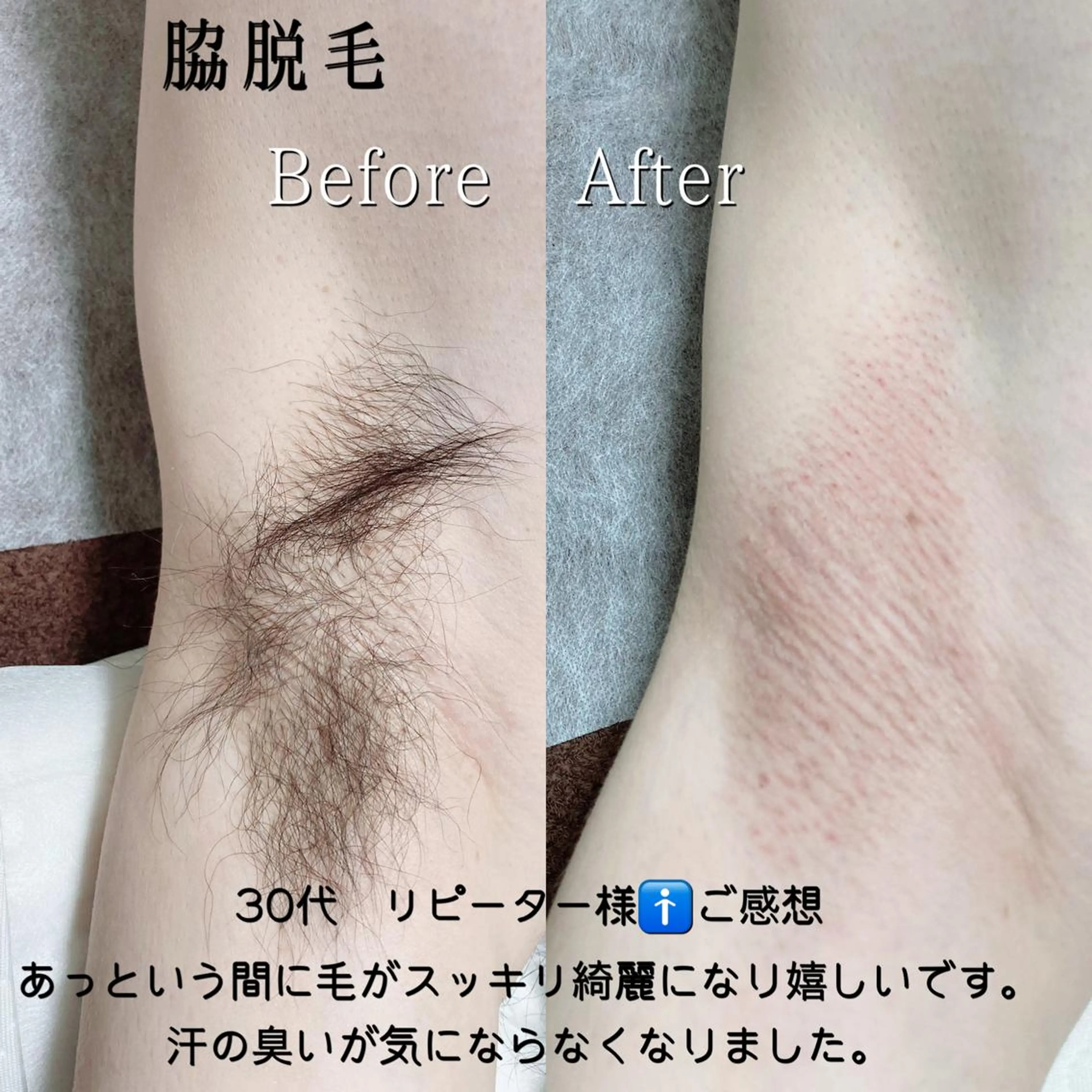 メンズ 脱毛サロン KiWiのエステ・リラクイメージ