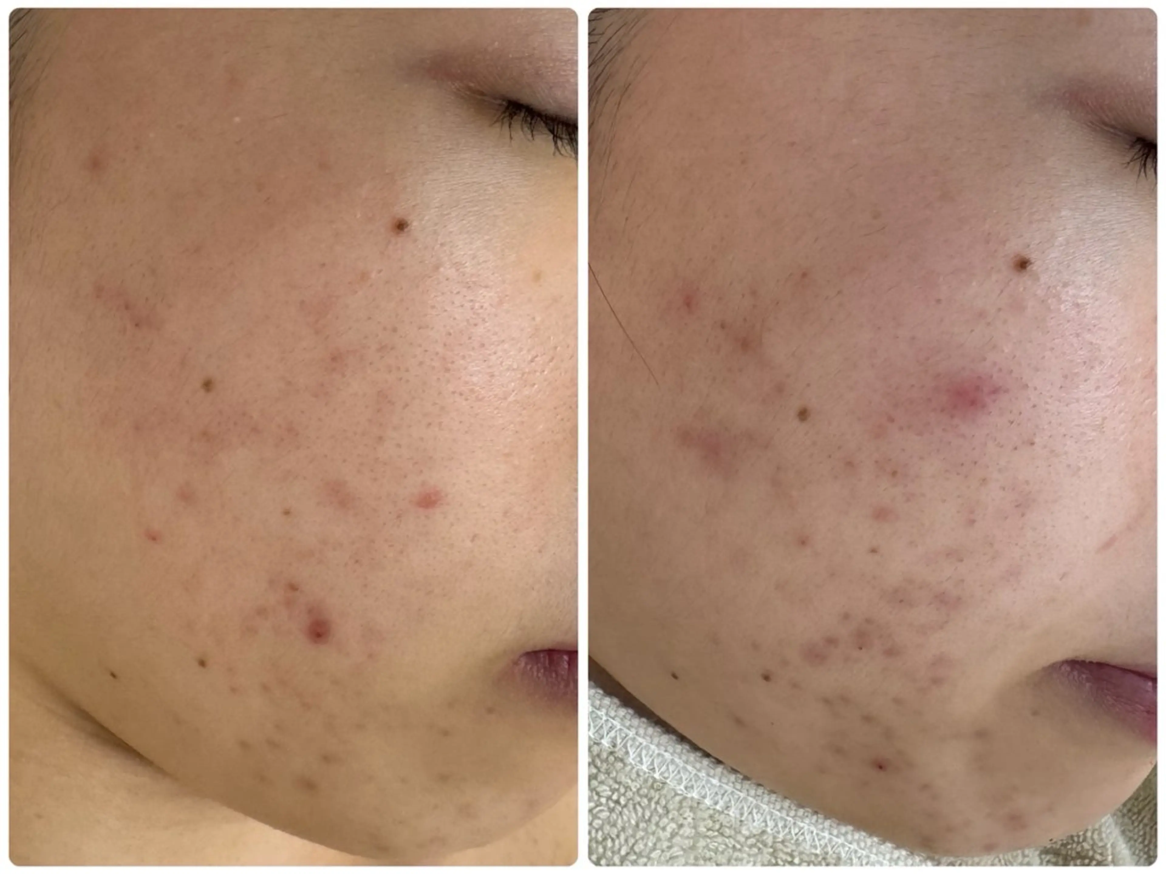 エステ リラク シミ毛穴専門店 yucca(ユッカ)のエステ・リラクイメージ