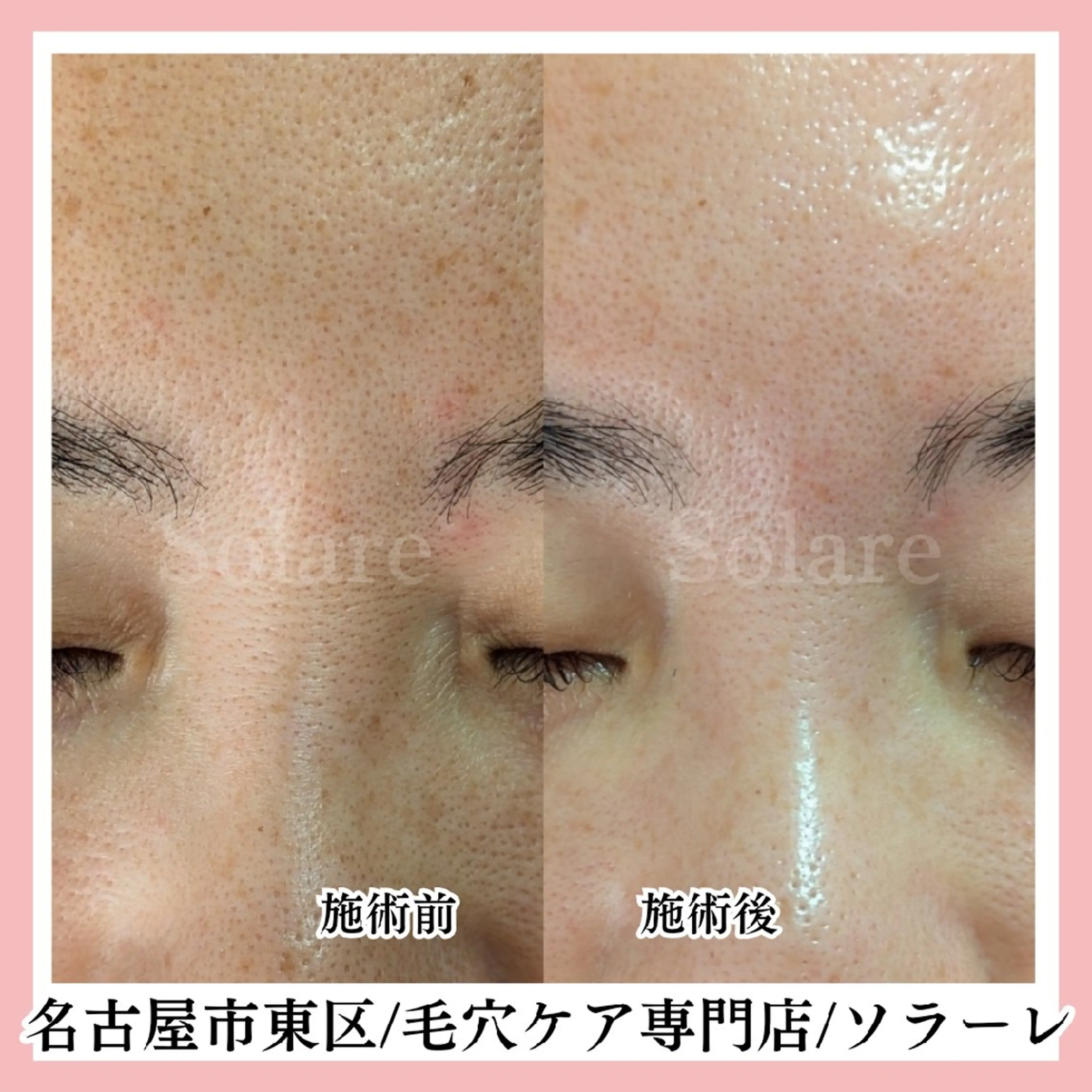  毛穴洗浄・まつ毛 の専門店 ソラーレのエステ・リラクイメージ