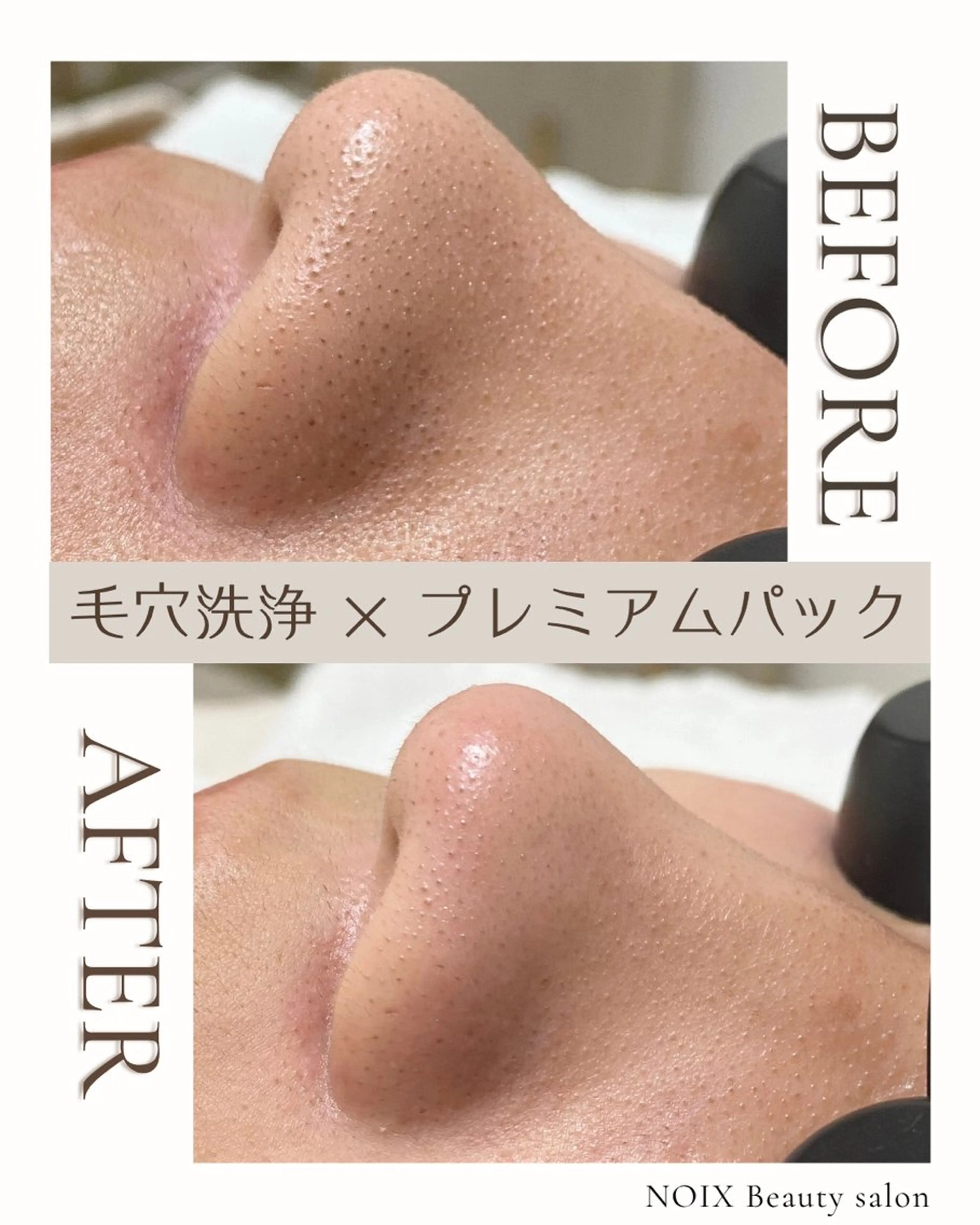 エステ NOIXbeauty salonの眉毛・アイブロウイメージ