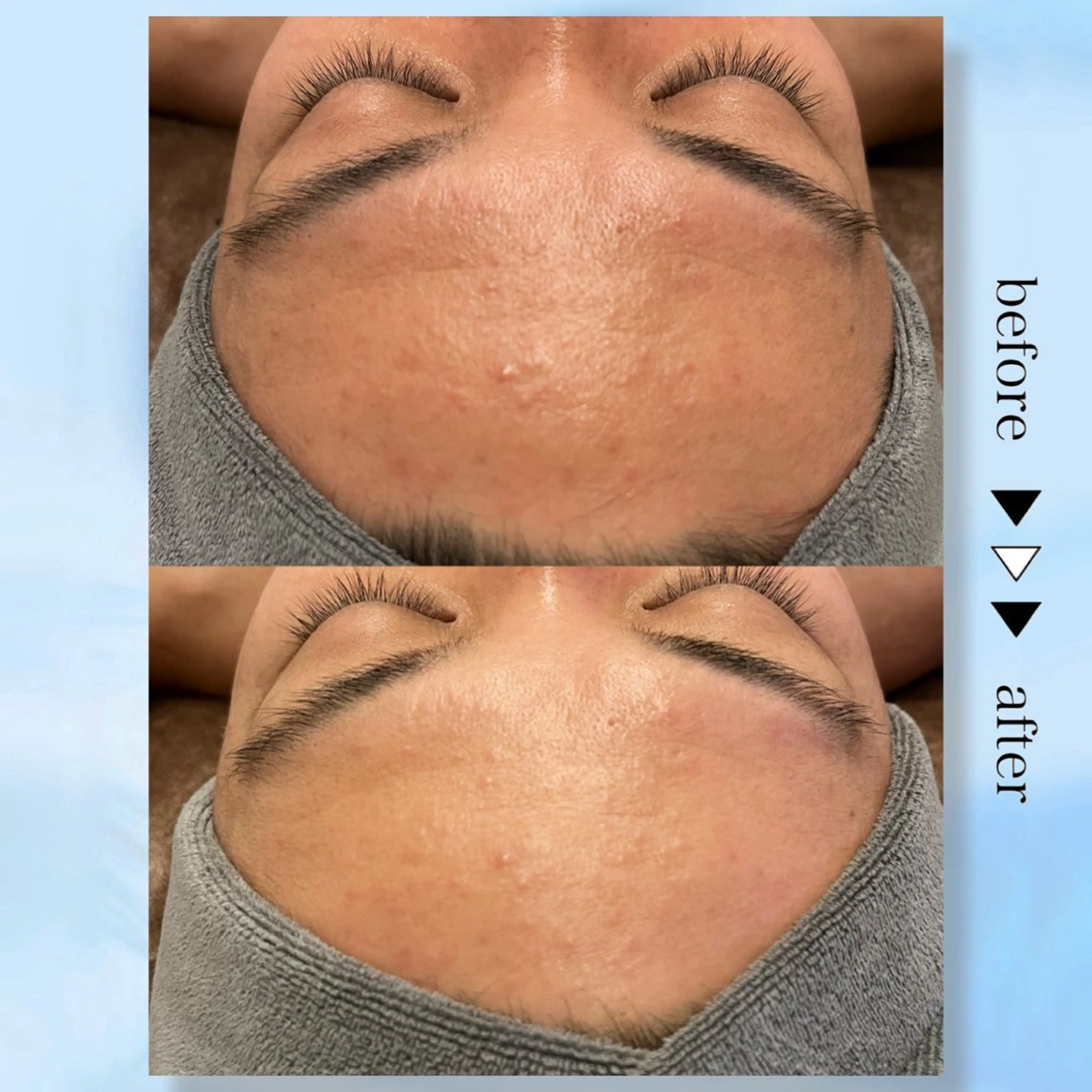 ☆痩身/小顔☆ コルギのエステ・リラクイメージ