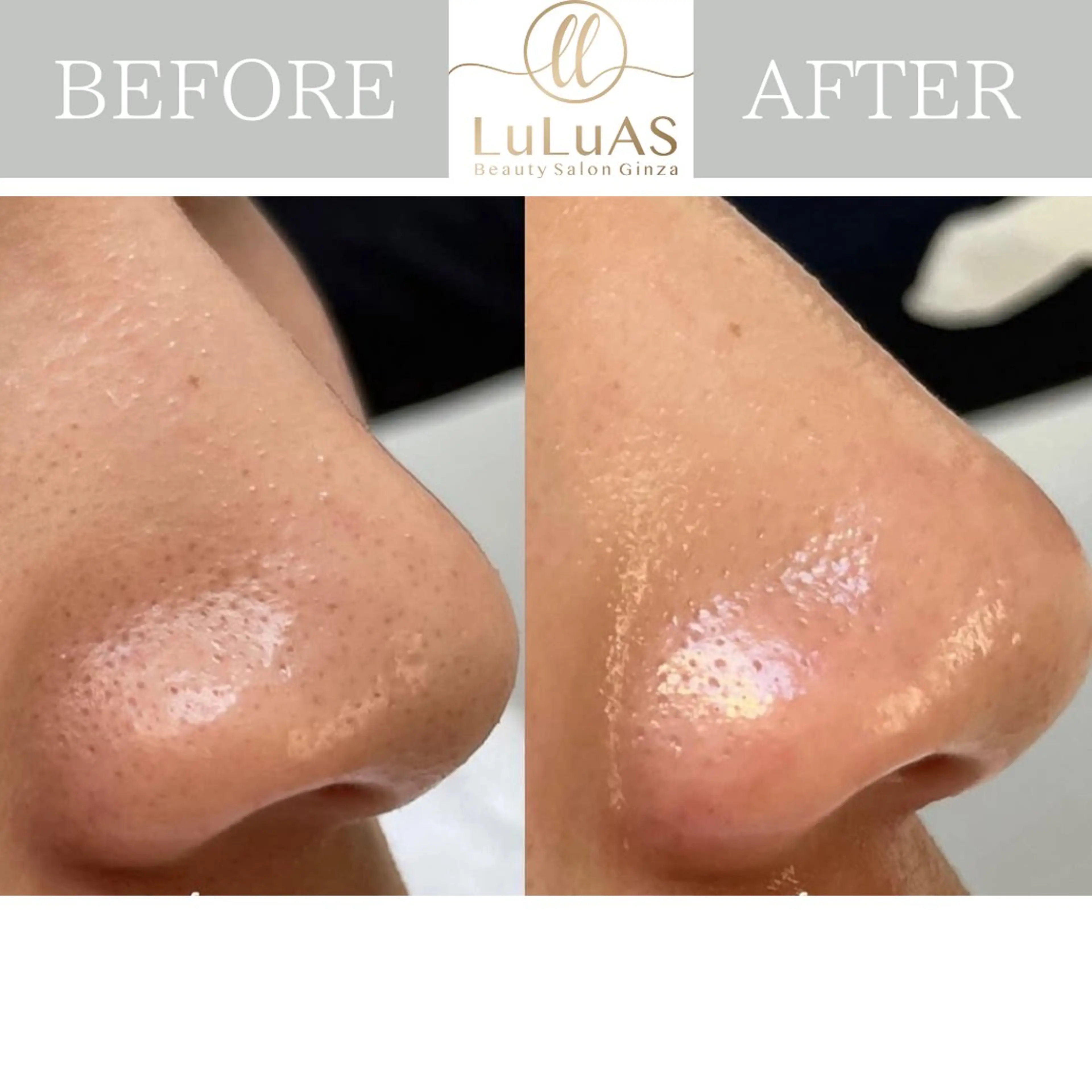 エステ リラク ルルアス GINZAのエステ・リラクイメージ