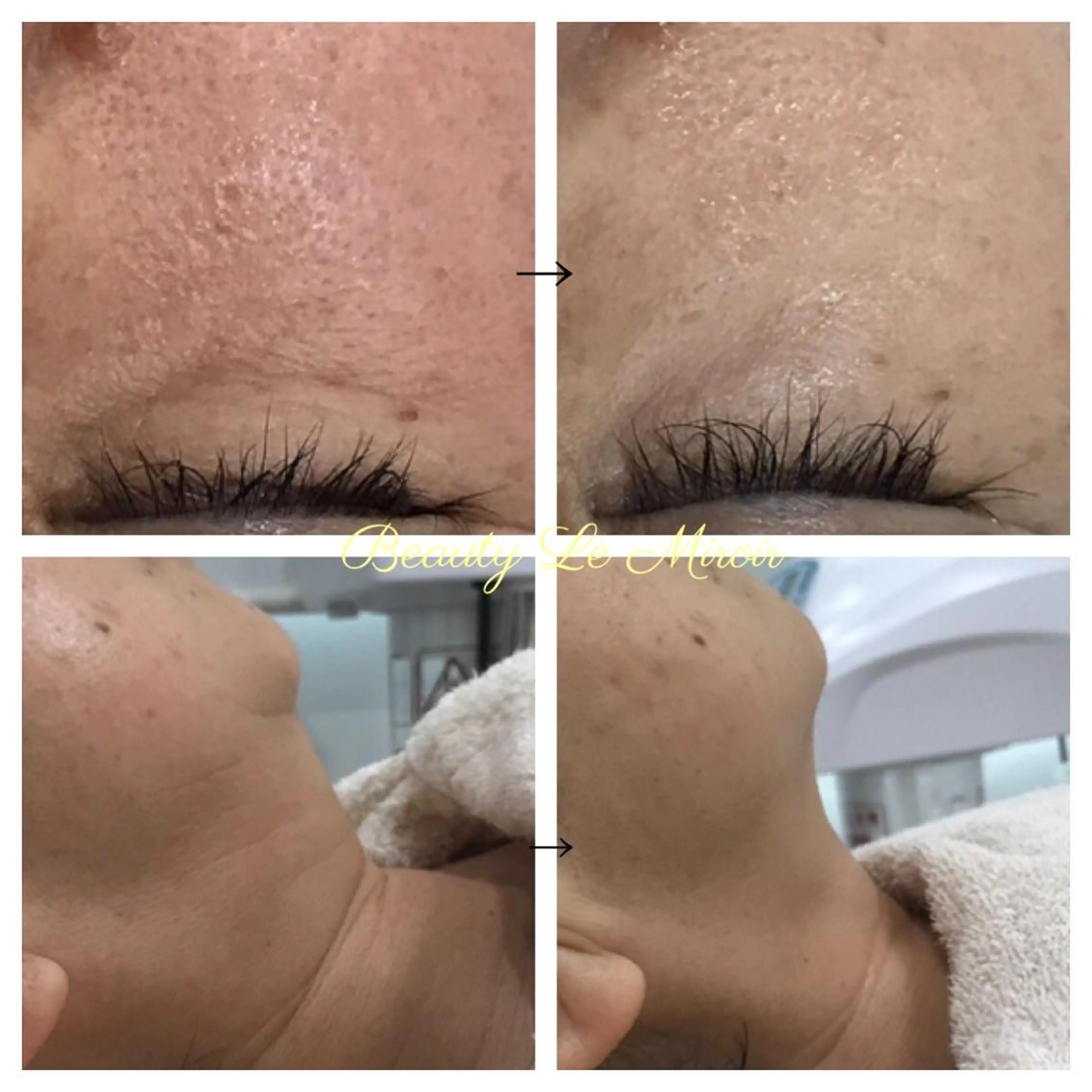 ビューティー ミロワールのエステ・リラクイメージ