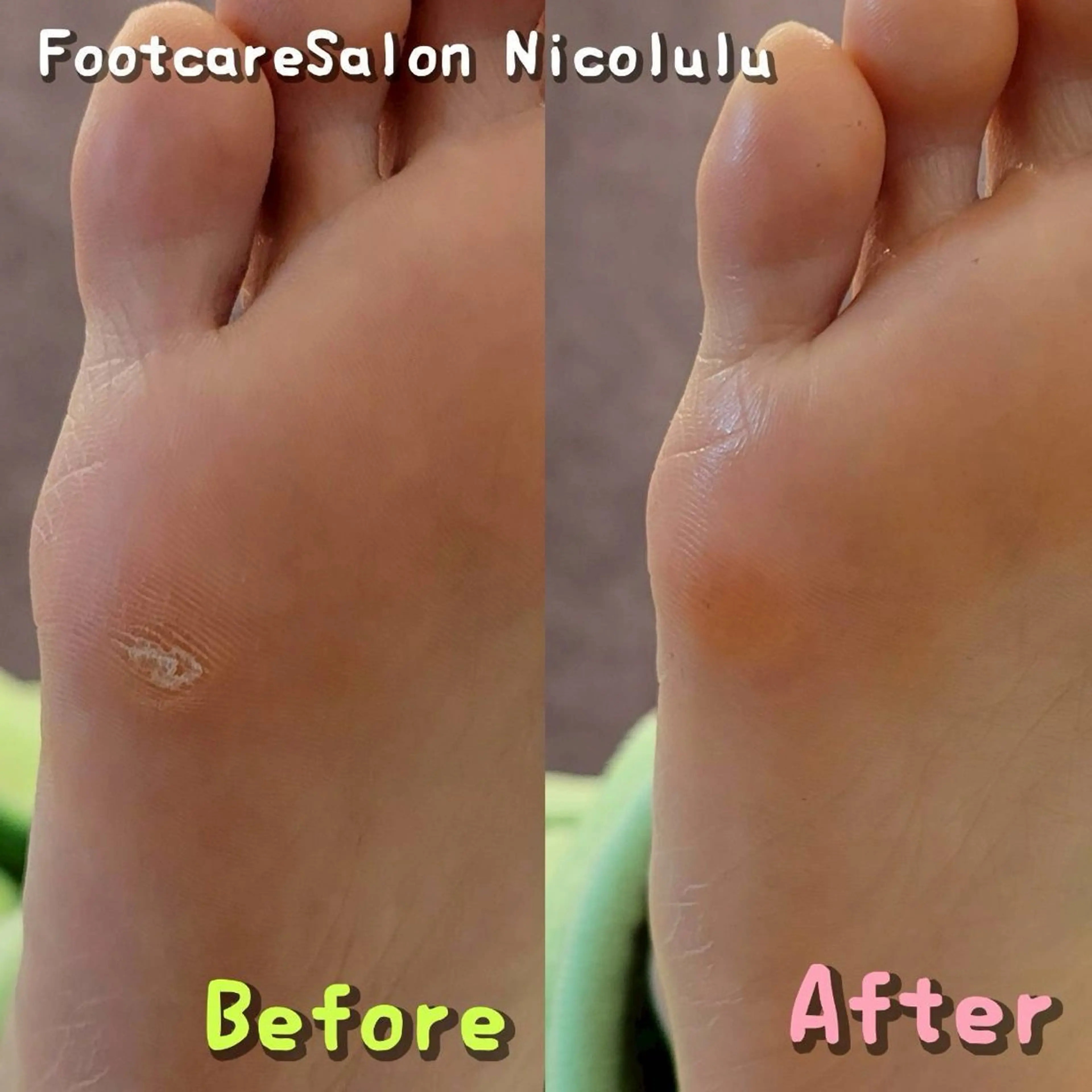 メンズ リラク 足トラブル専門 ニコルル金沢のエステ・リラクイメージ