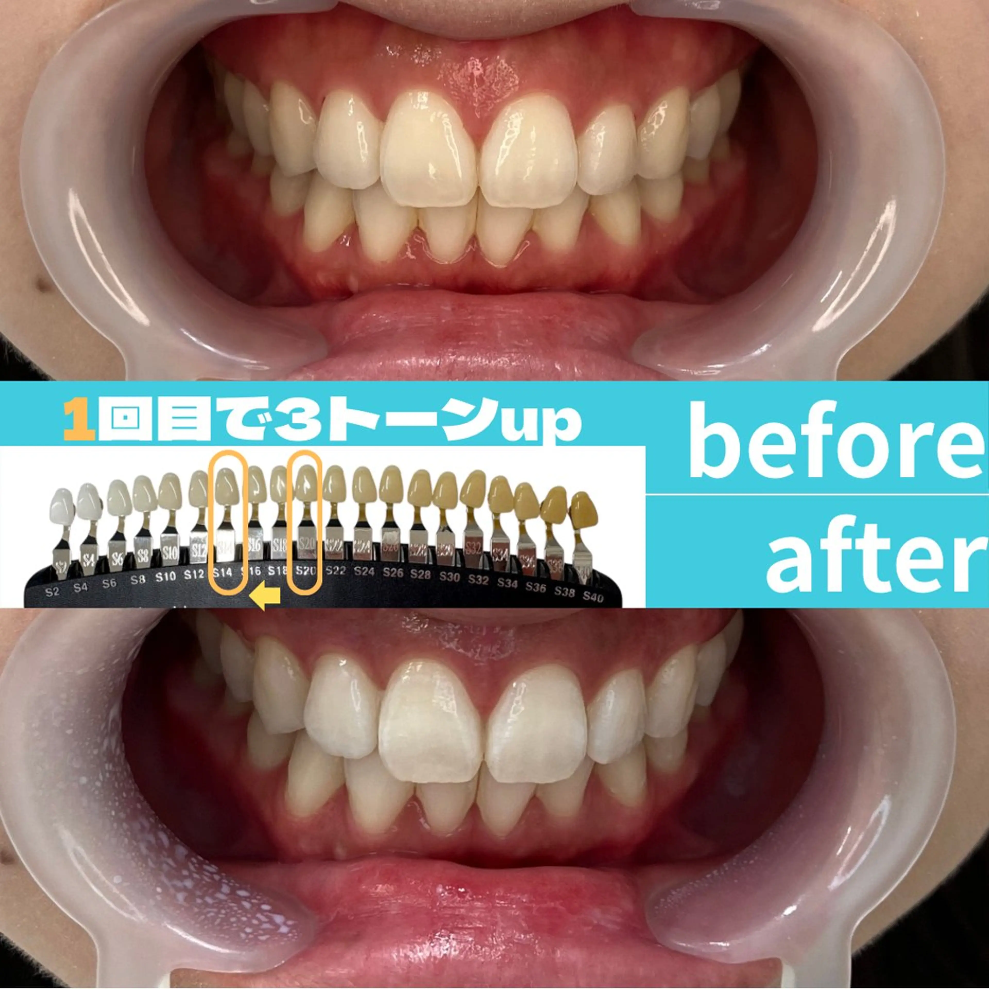 エステ s rikoのエステ・リラクイメージ