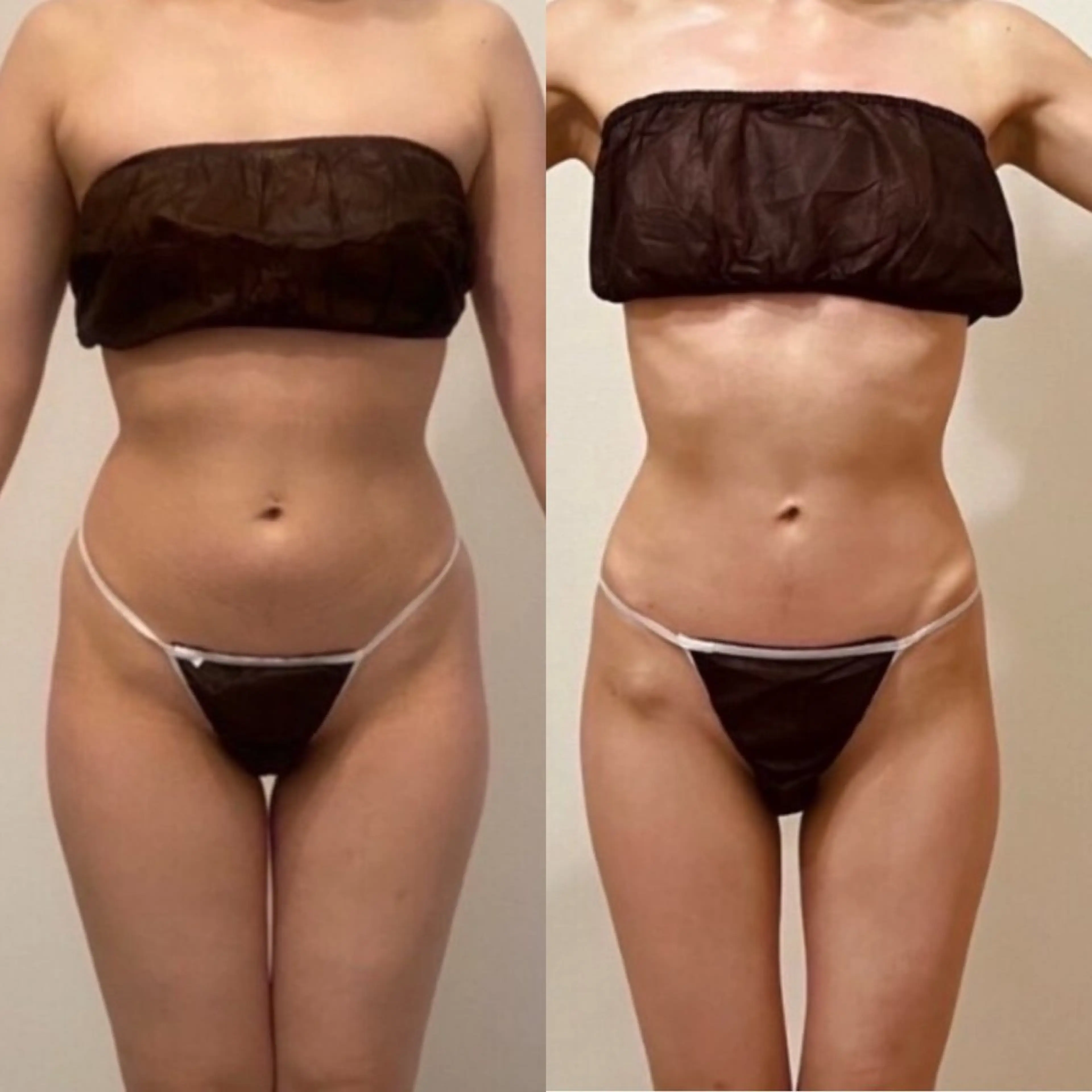 エステ Re:Oasis所属・🦋Re:Oasis 近藤美貴【四谷】🦋のエステ・リラクイメージ