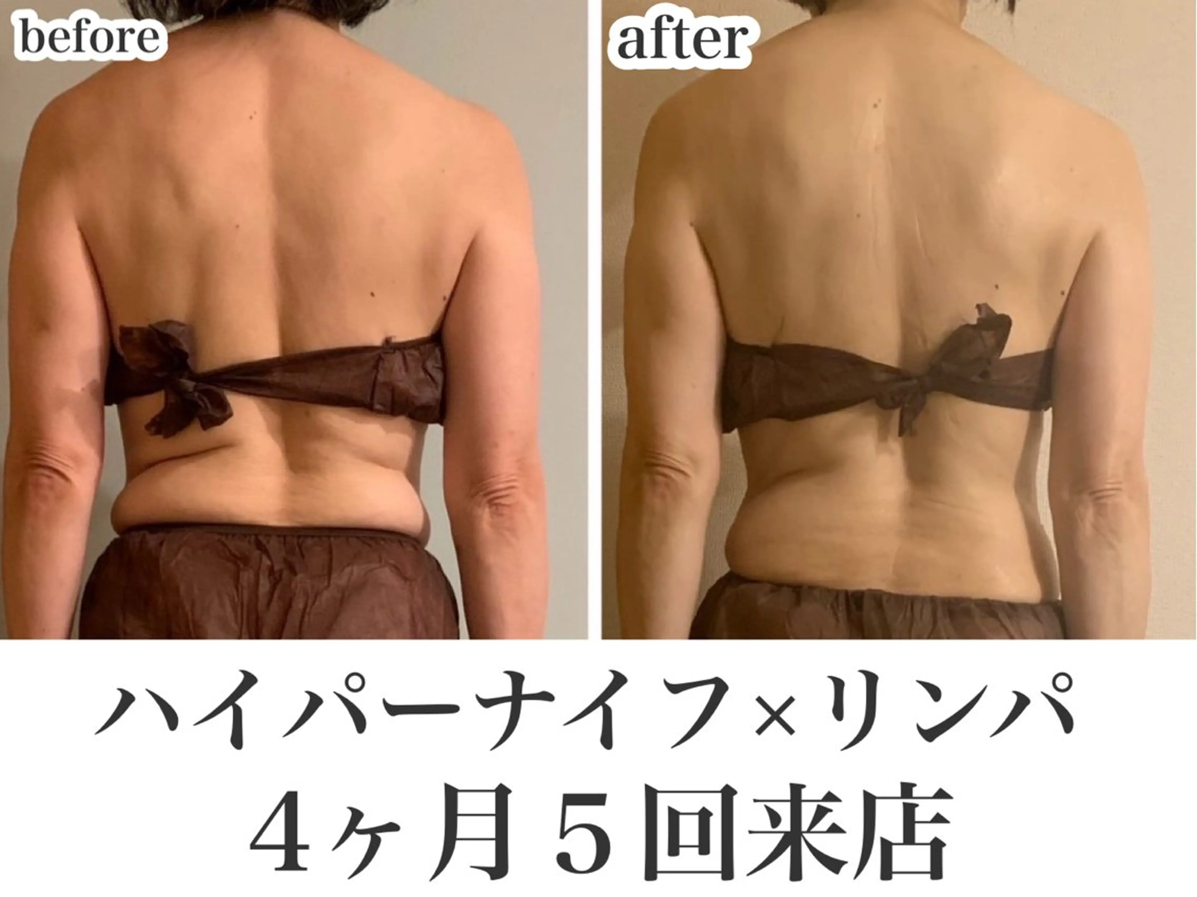 REME/リミー エステサロン東大宮店所属・小林 雪乃のエステ・リラクイメージ