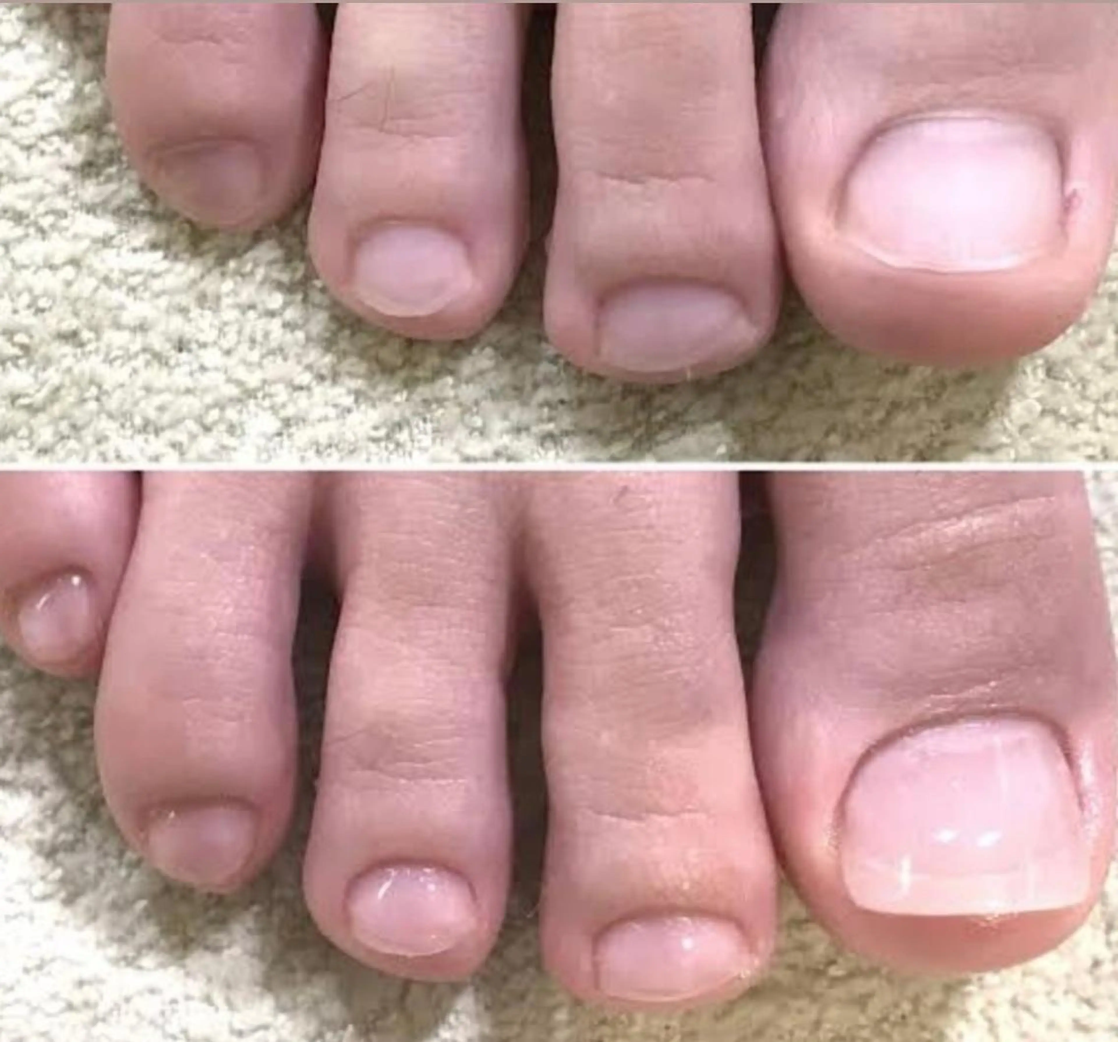 ネイル 大塚眉毛|ハンドケア |肌管理の眉毛・アイブロウイメージ