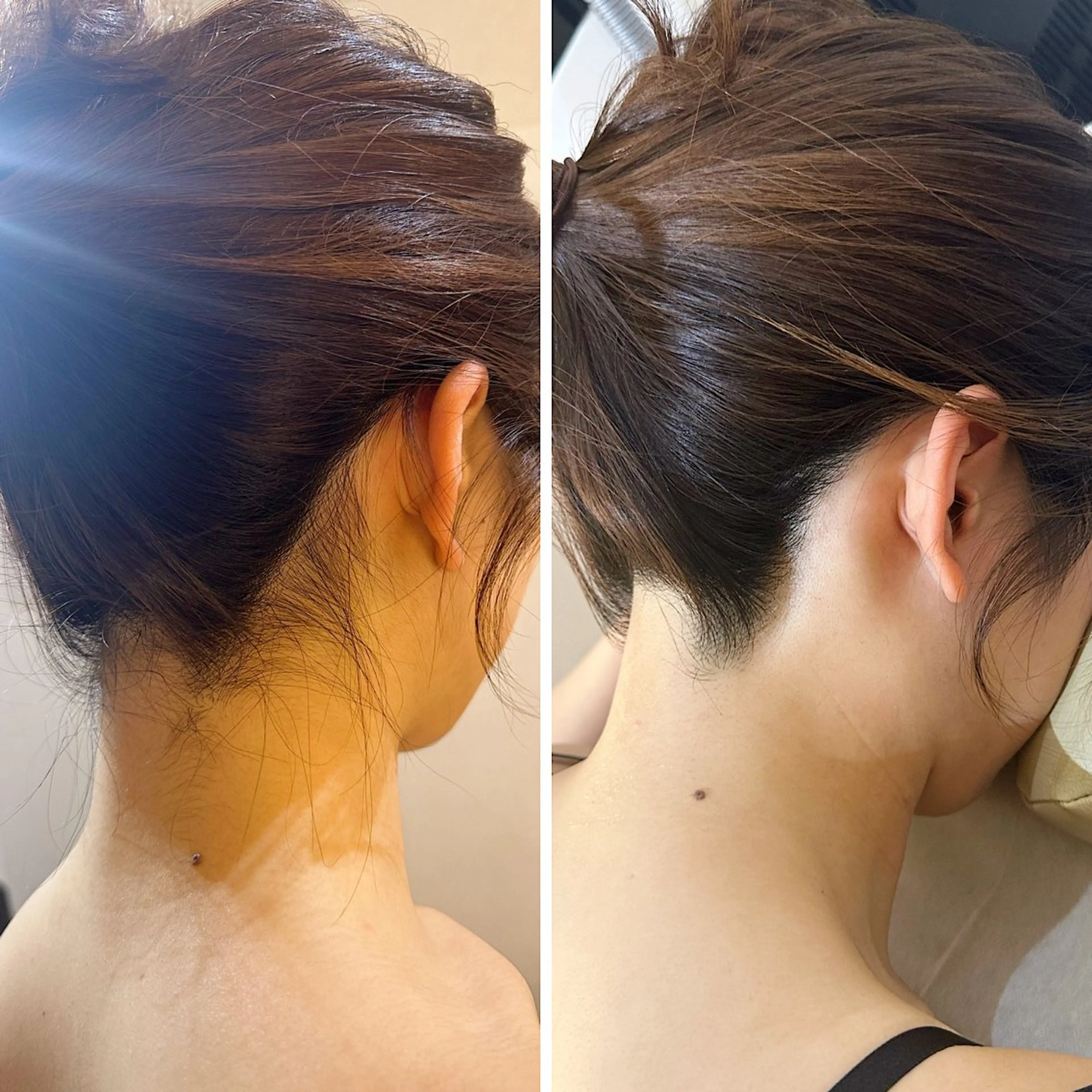 脱毛 うなじ脱毛/美肌脱毛 LABELのエステ・リラクイメージ