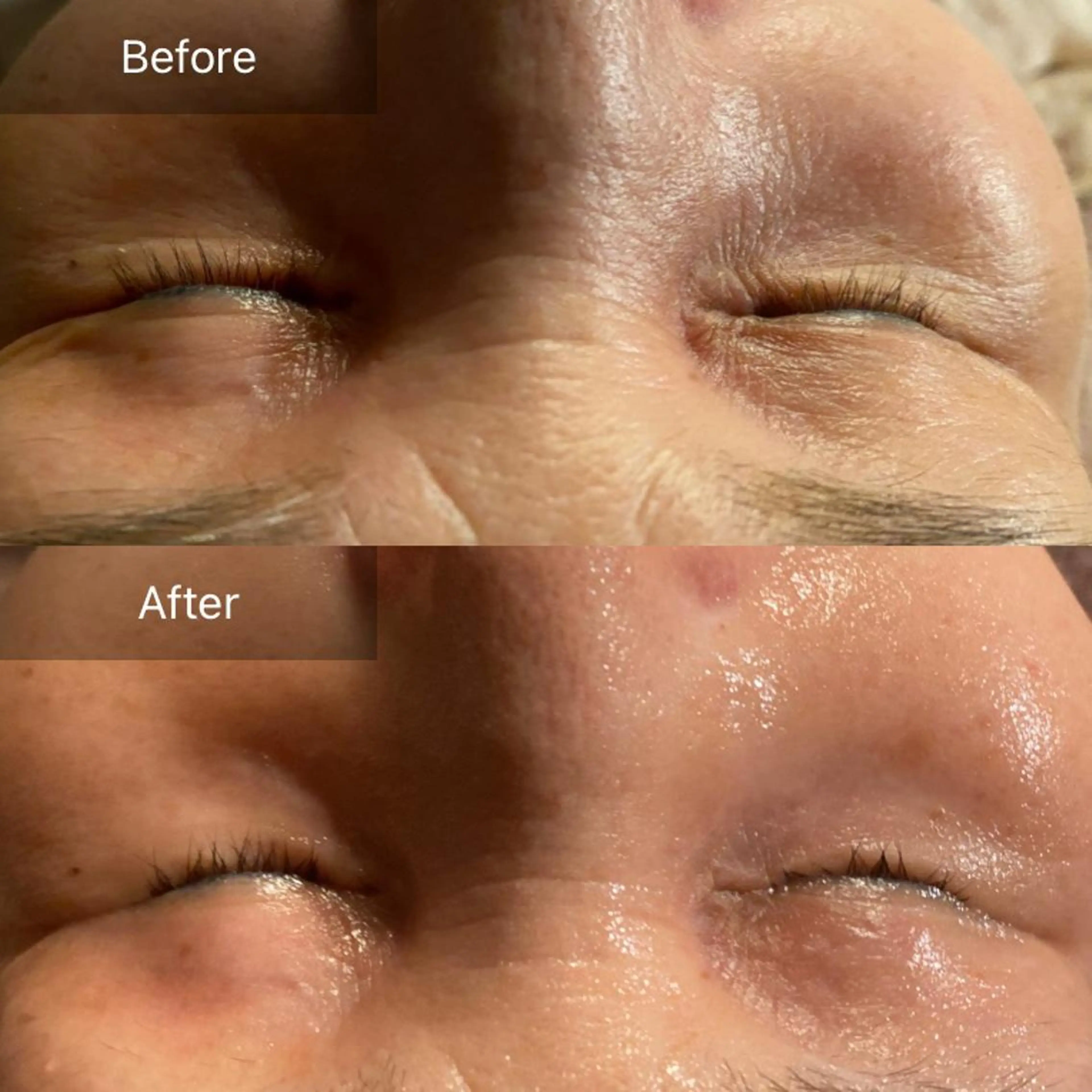 Mandarin Orange所属・毛穴から始める肌メン テマンダリンオレンジのエステ・リラクイメージ