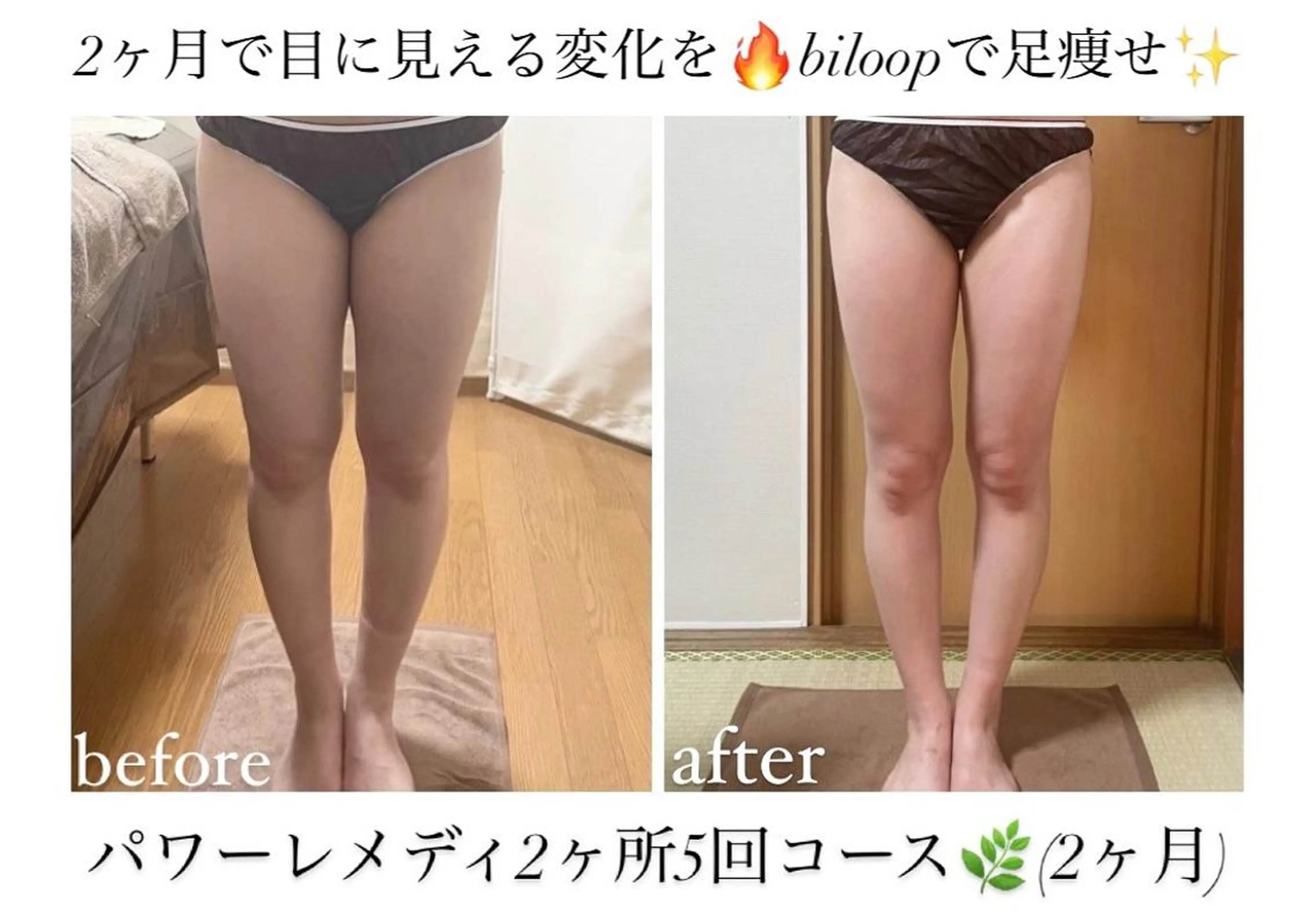 biloop所属・《本気痩せ×疲労改善 》  BILOOPのエステ・リラクイメージ