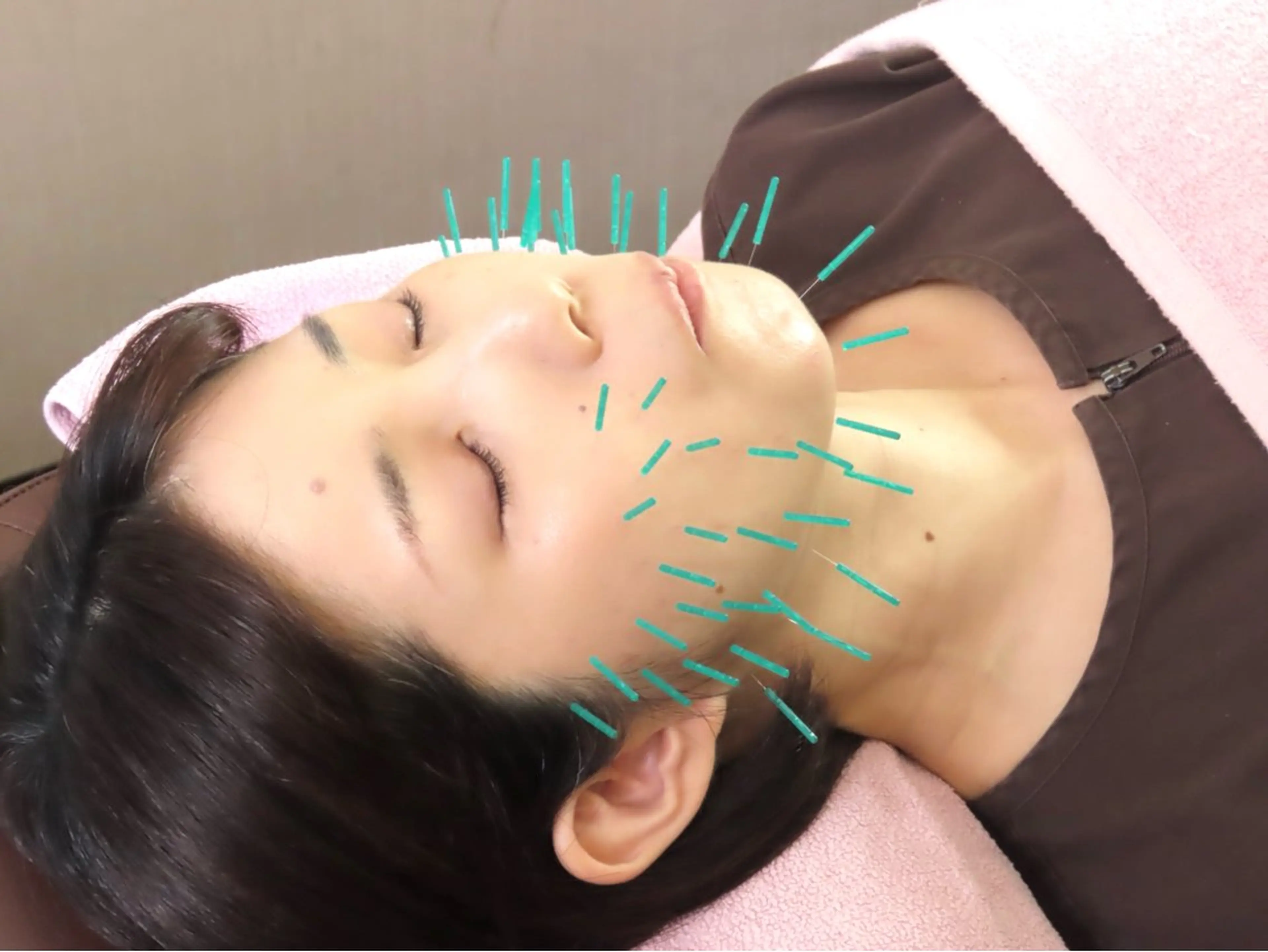 エステ リラク 中村 峻也(鍼灸師)のエステ・リラクイメージ