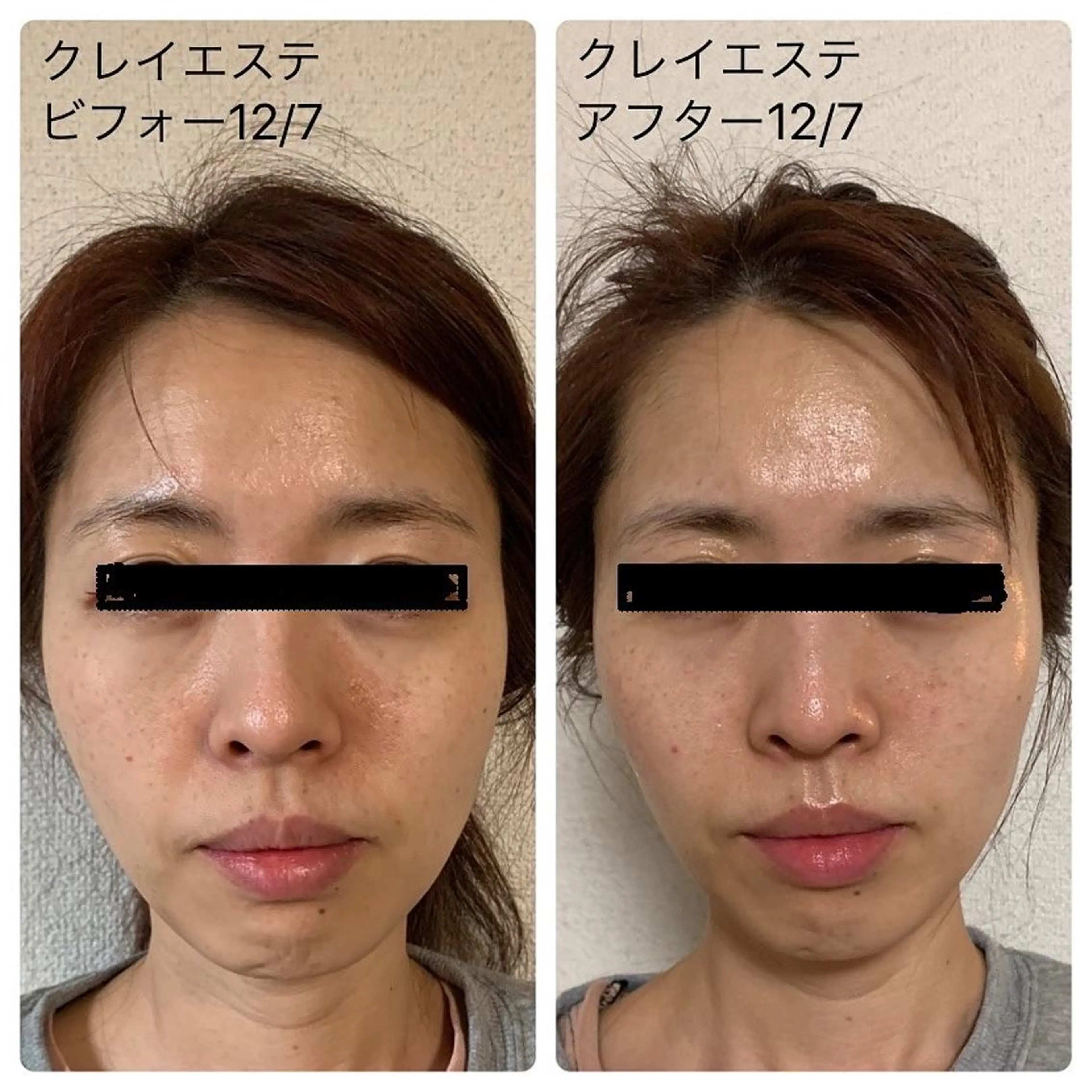 💆‍♀️松田 亜沙美のエステ・リラクイメージ