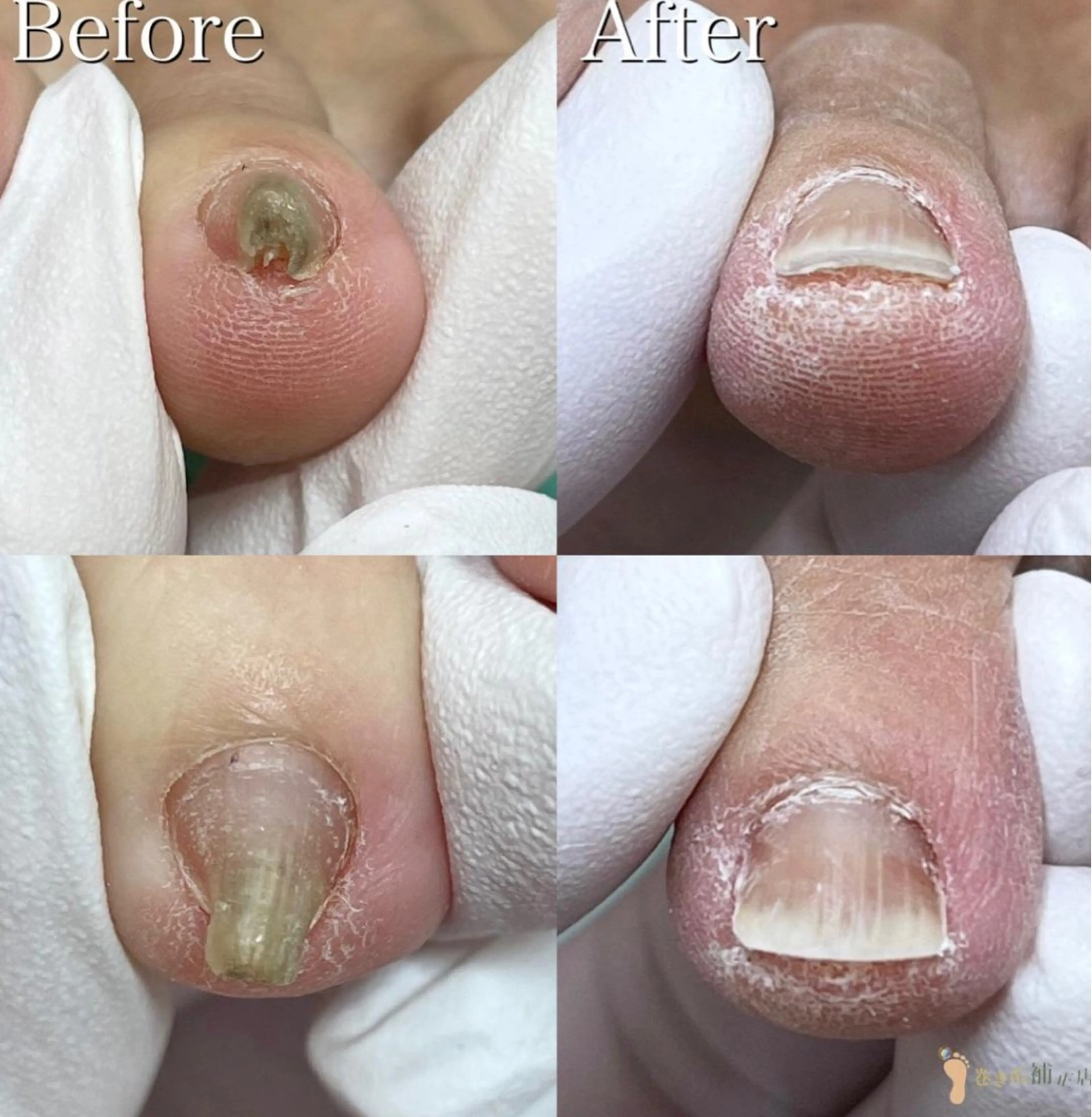 リラク 福岡巻き爪補正店 博多店のエステ・リラクイメージ